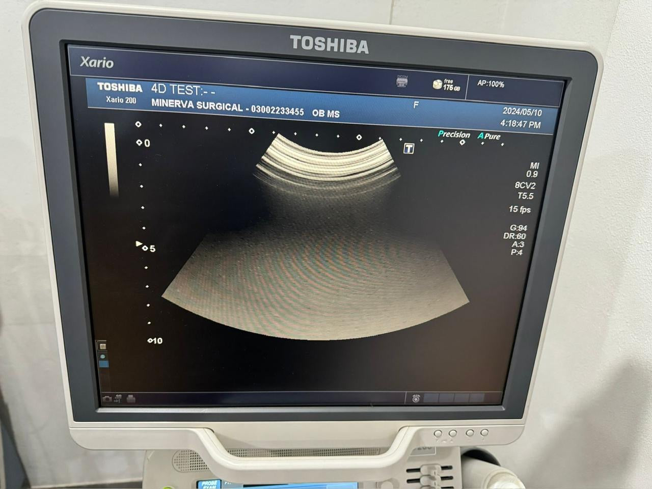 TOSHIBA PVU-674MV / 8CV2
CURVED PROBE