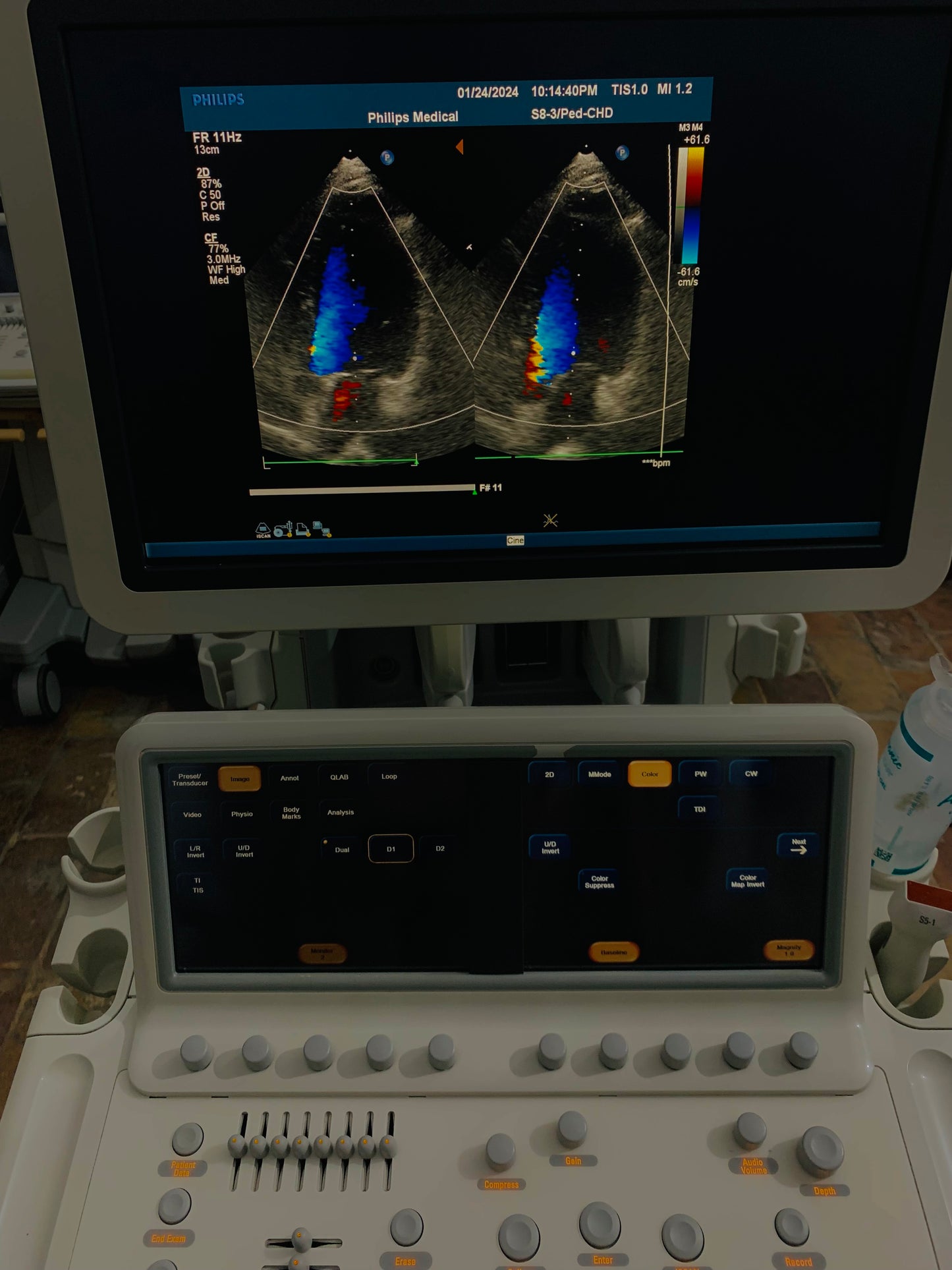 Philips IE 33 Ultrasound Machine