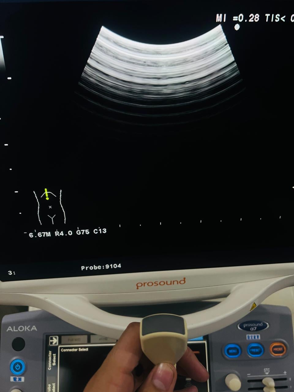 ..Aloka UST-9104-5 micro-convex probe