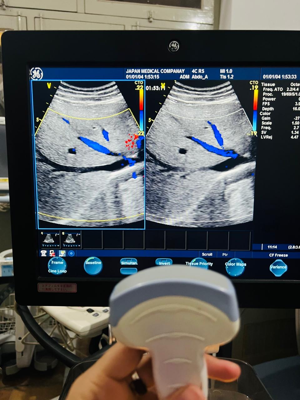 ..GE 4C RS Probe num 8