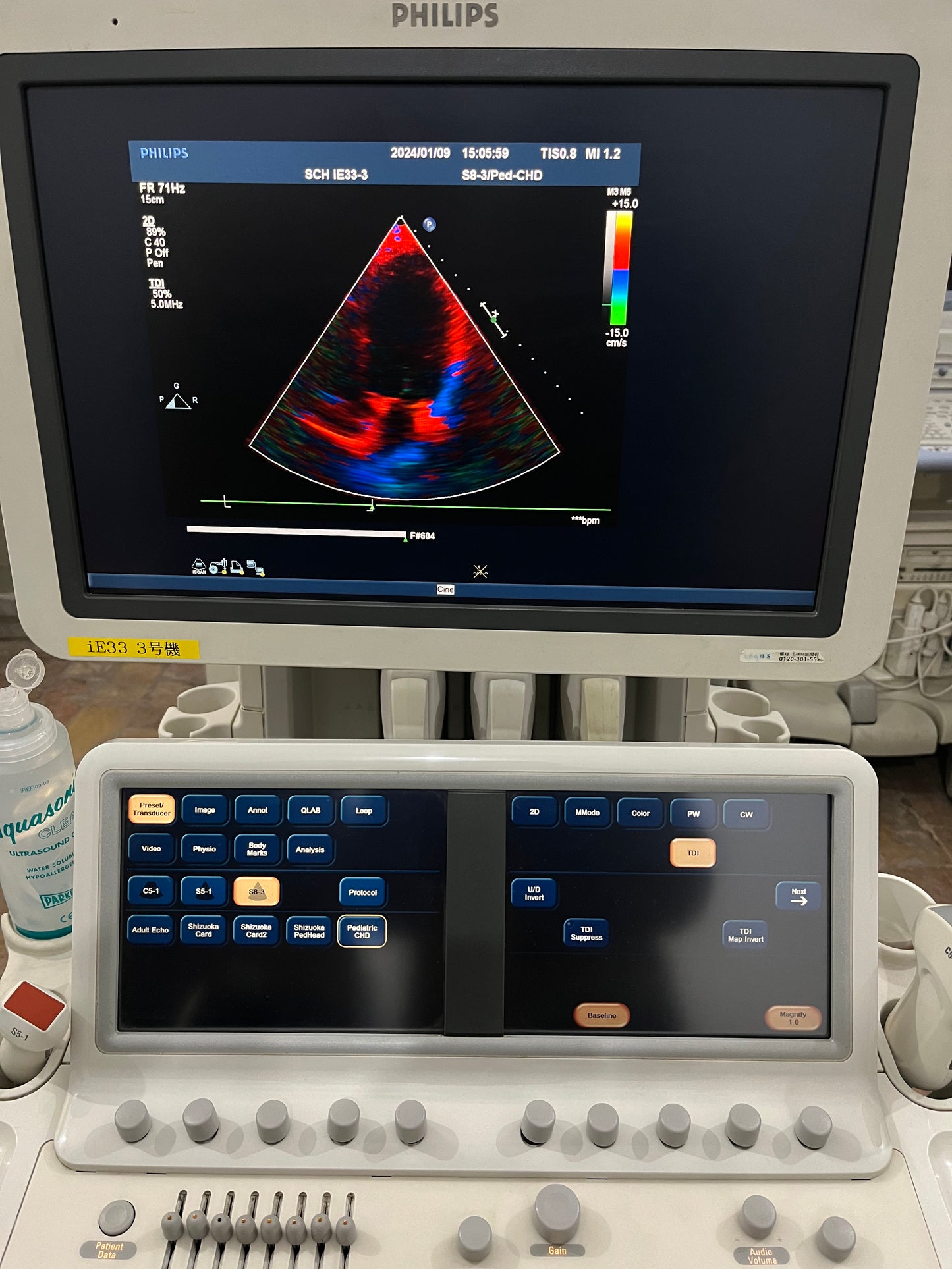 Phillips IE33 Dedicated Echocardiography - Japan Medical Company LTD