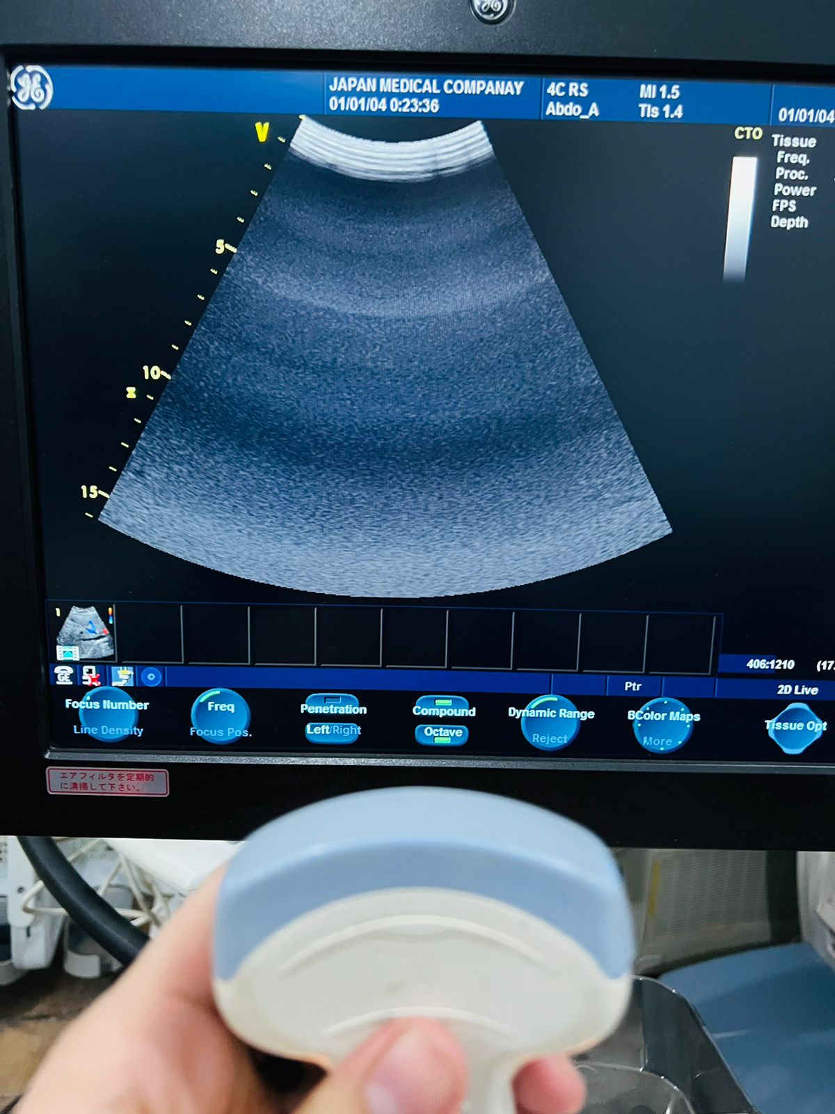 ..GE 4C RS probe number 17.