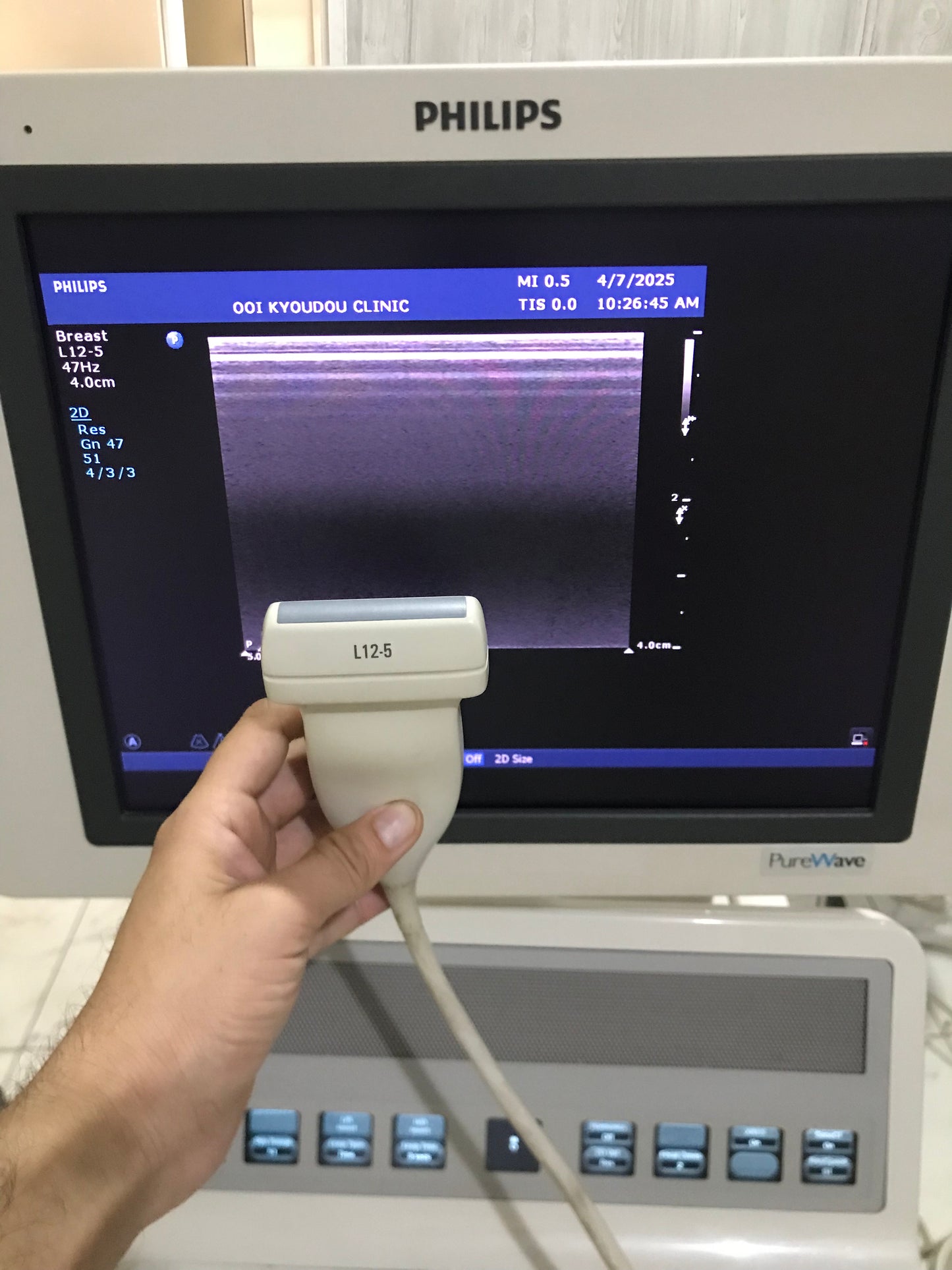 ..Philips L12-5 Linear Probe UC