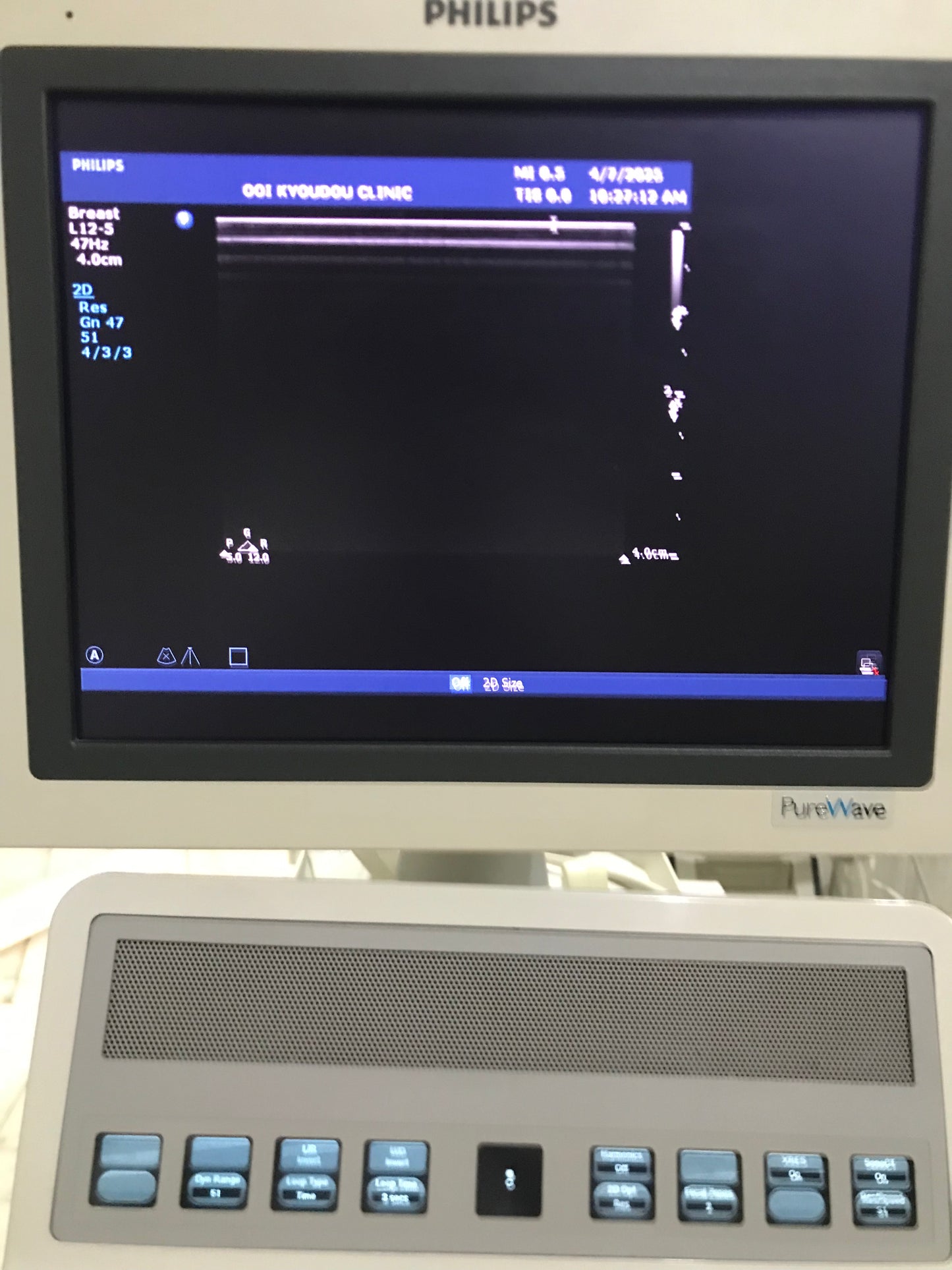 ..Philips L12-5 Linear Probe UC