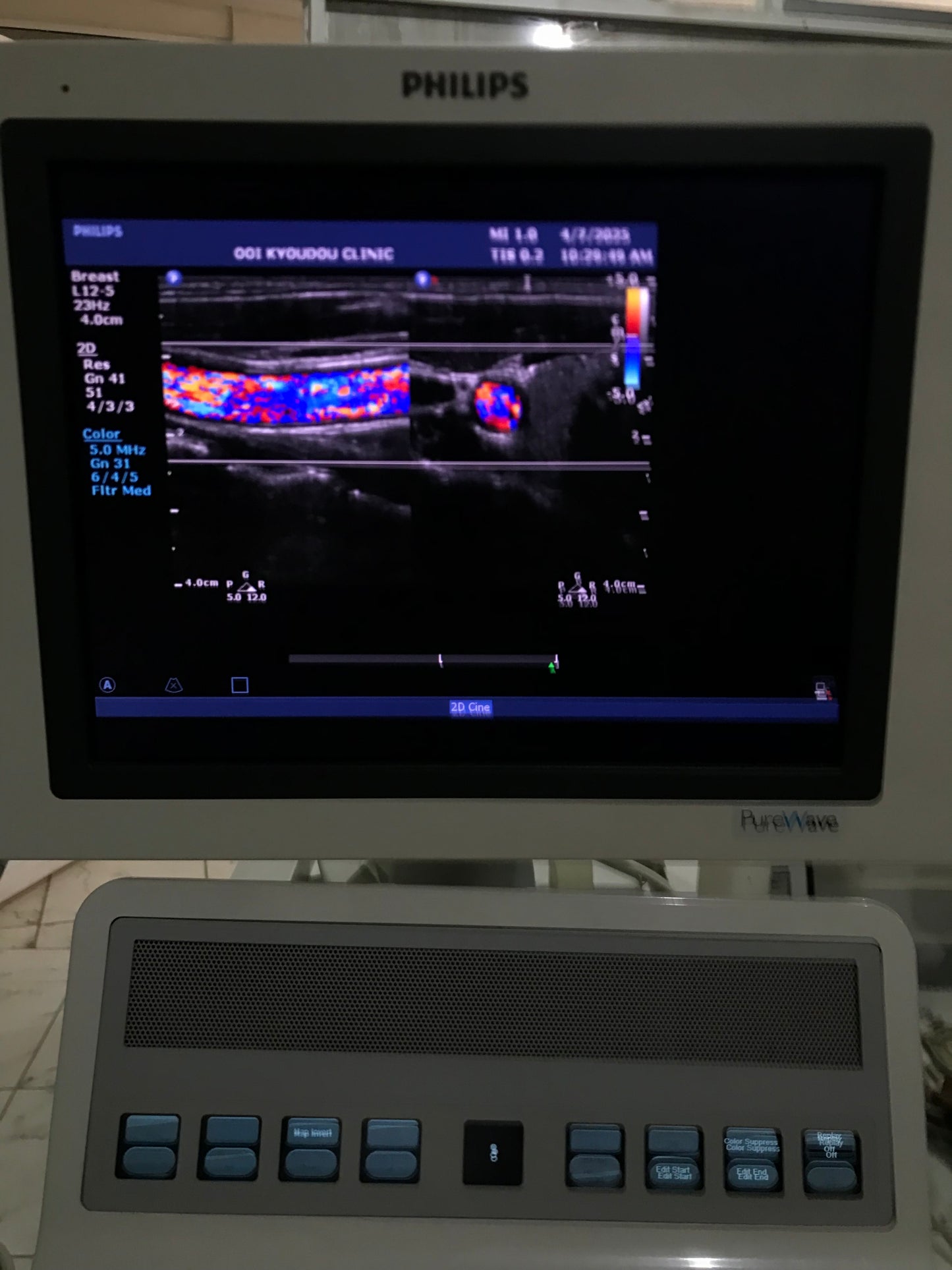 ..Philips L12-5 Linear Probe UC