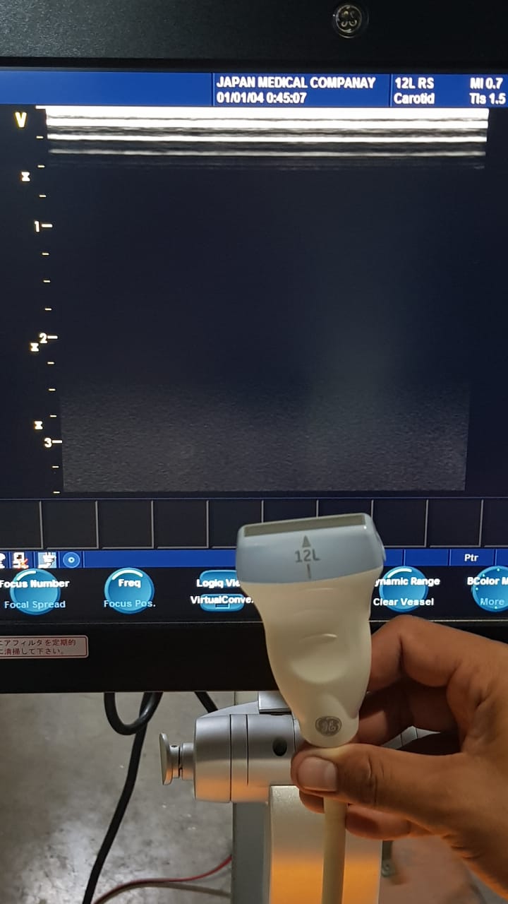 GE 12L-RS Mfg: 2012 Linear Vascular Probe