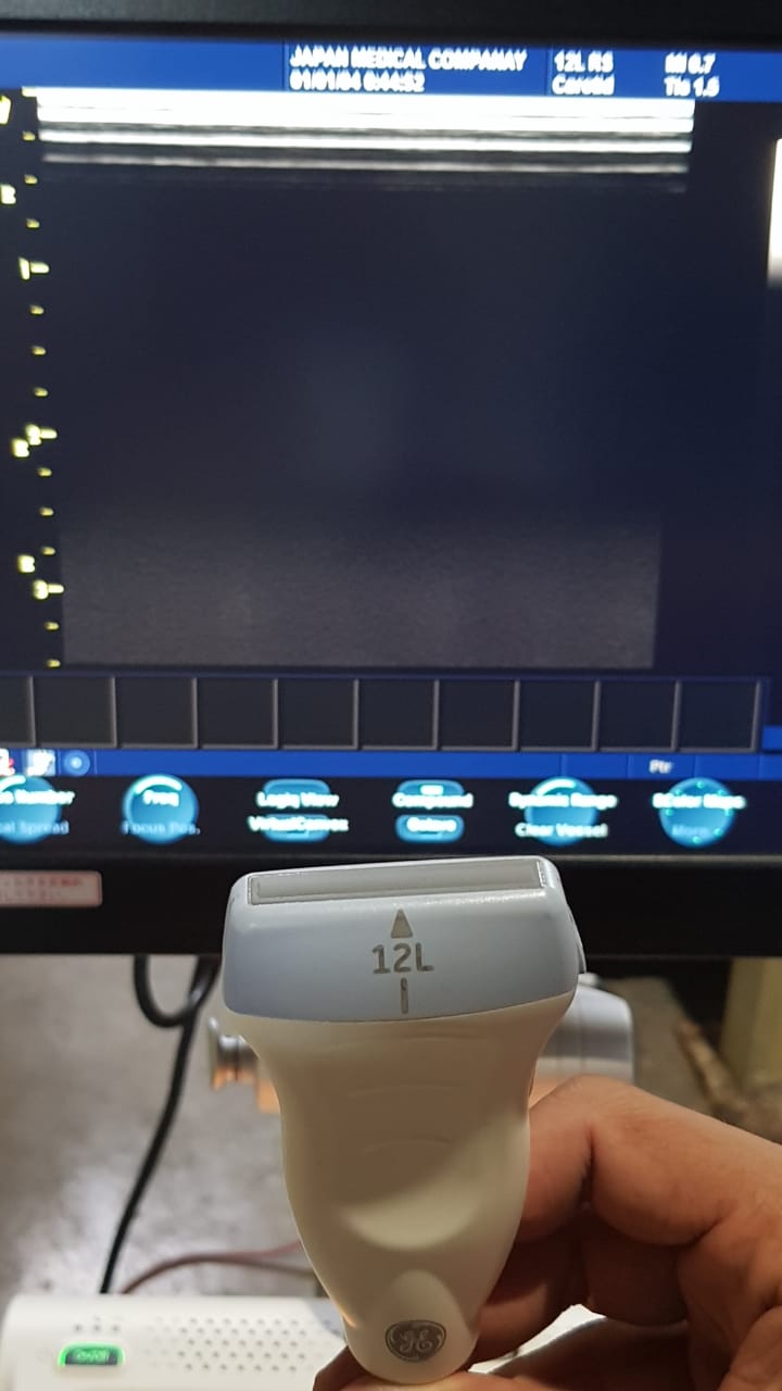 GE 12L-RS Mfg: 2012 Linear Vascular Probe