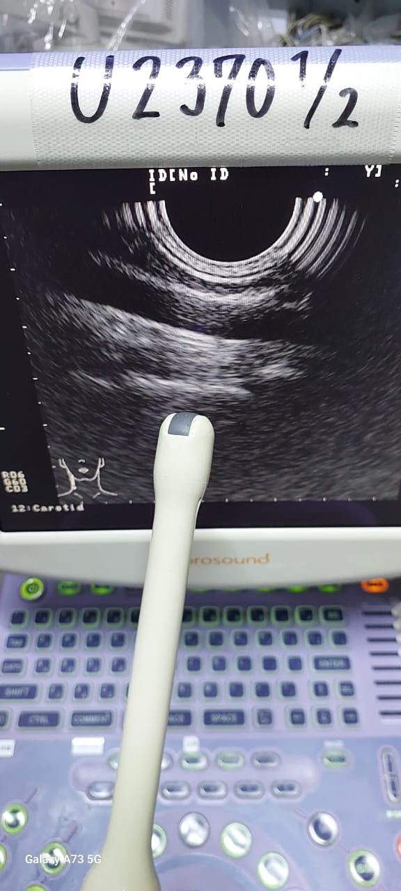 Aloka Prosound 6 without probes - Japan Medical Company LTD