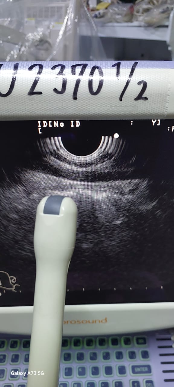 Aloka Prosound 6 without probes - Japan Medical Company LTD