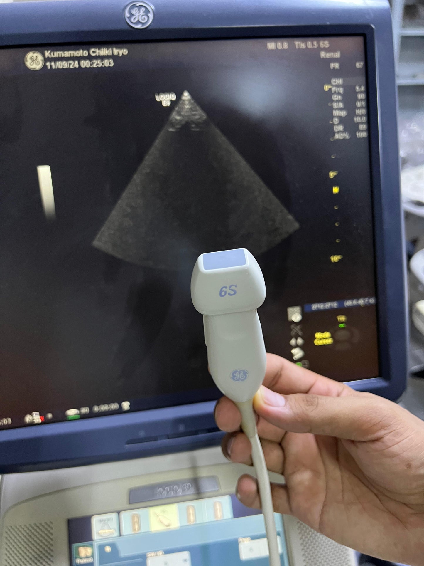 GE 6S-D Sector Array Probe Mfg: 2011