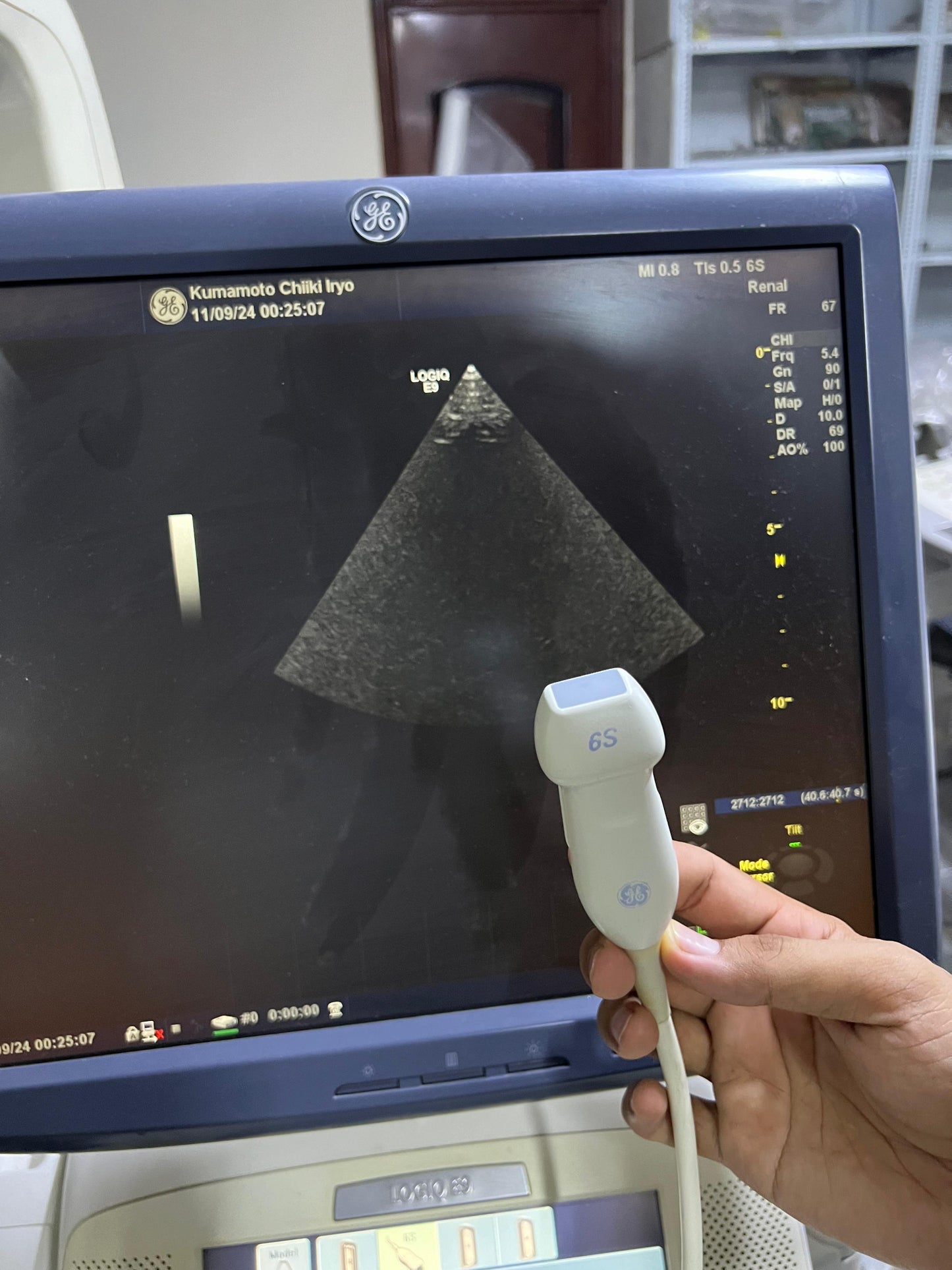 GE 6S-D Sector Array Probe Mfg: 2011