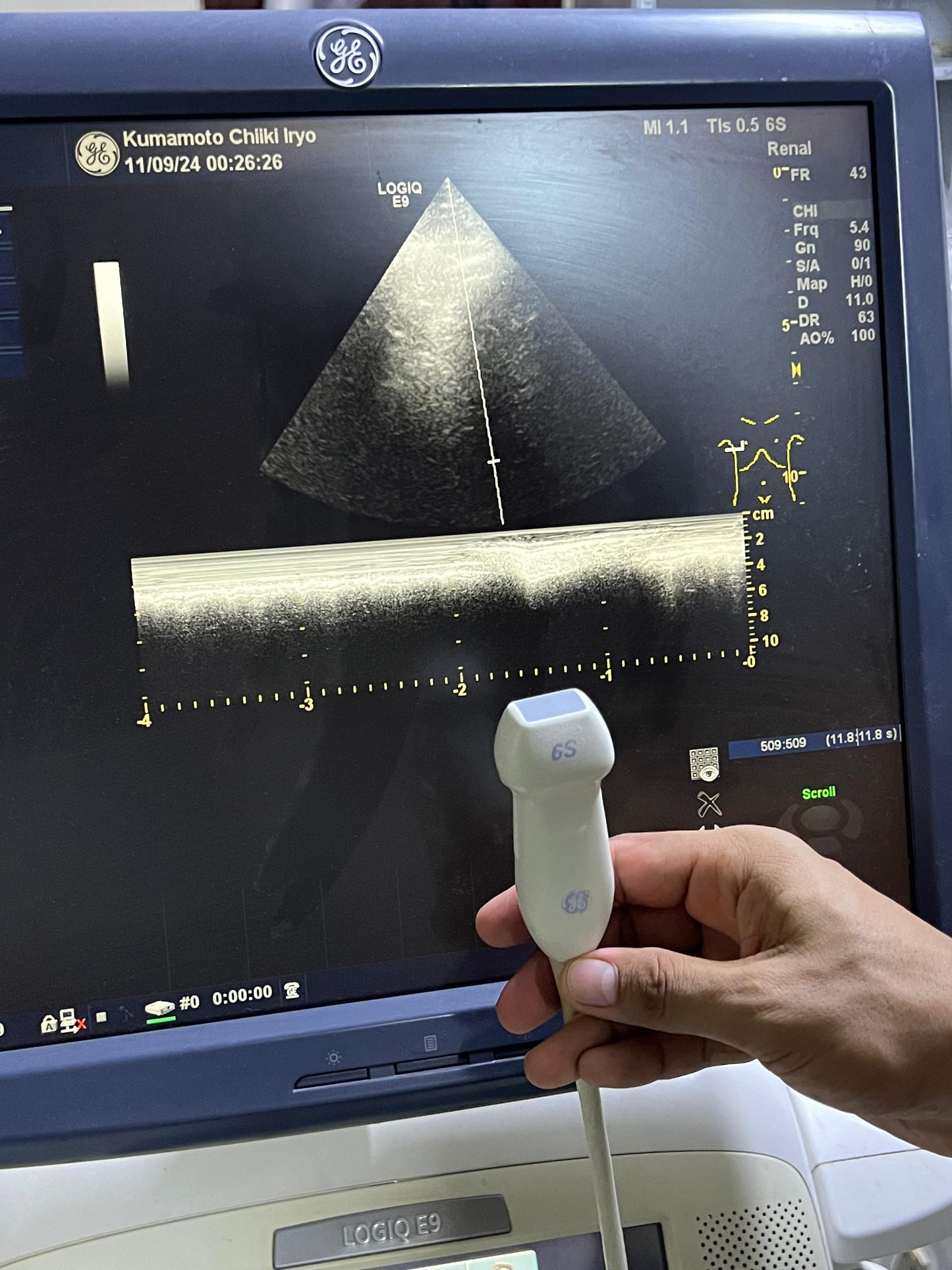 GE 6S-D Sector Array Probe Mfg: 2011
