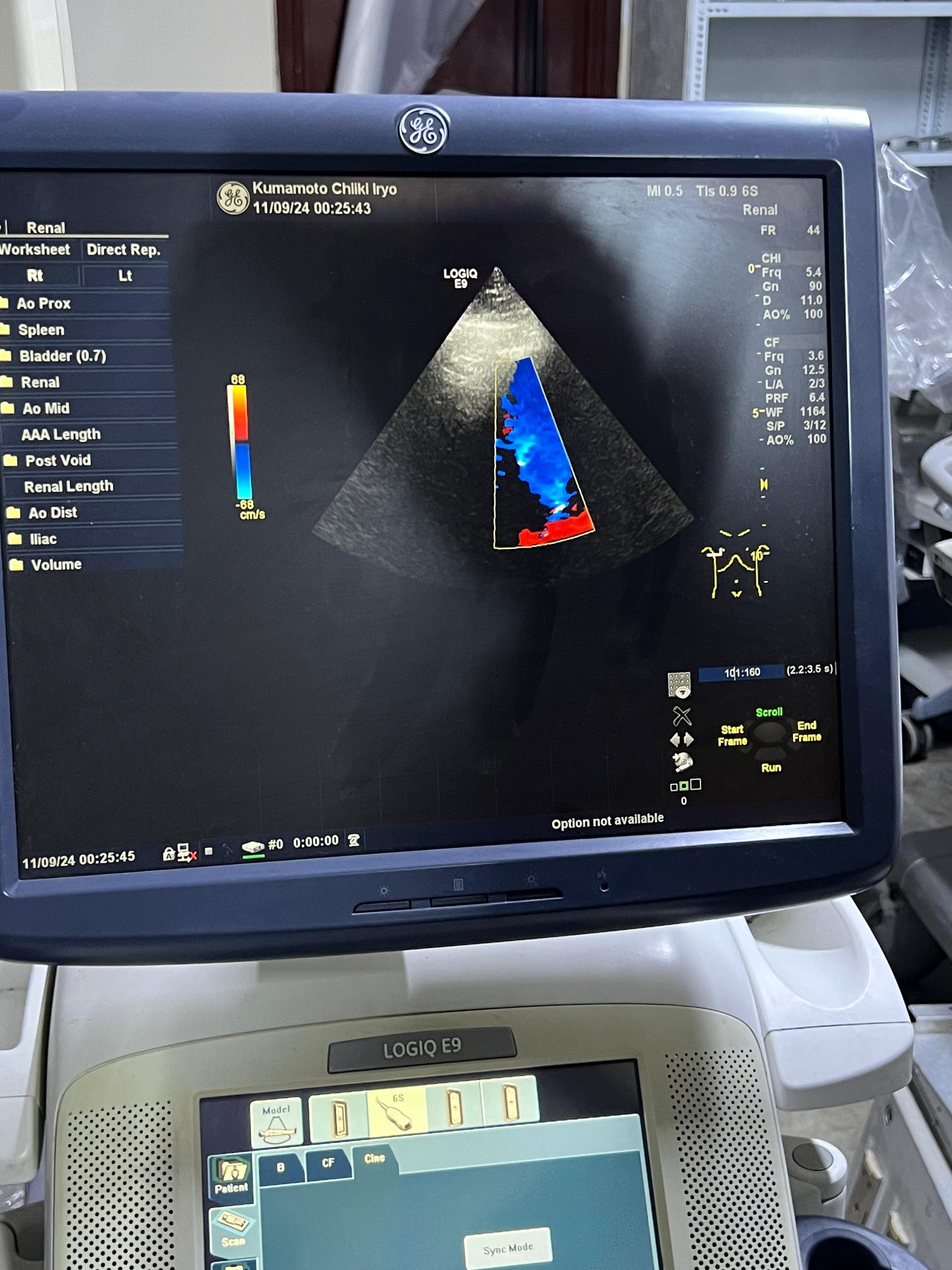 GE 6S-D Sector Array Probe Mfg: 2011