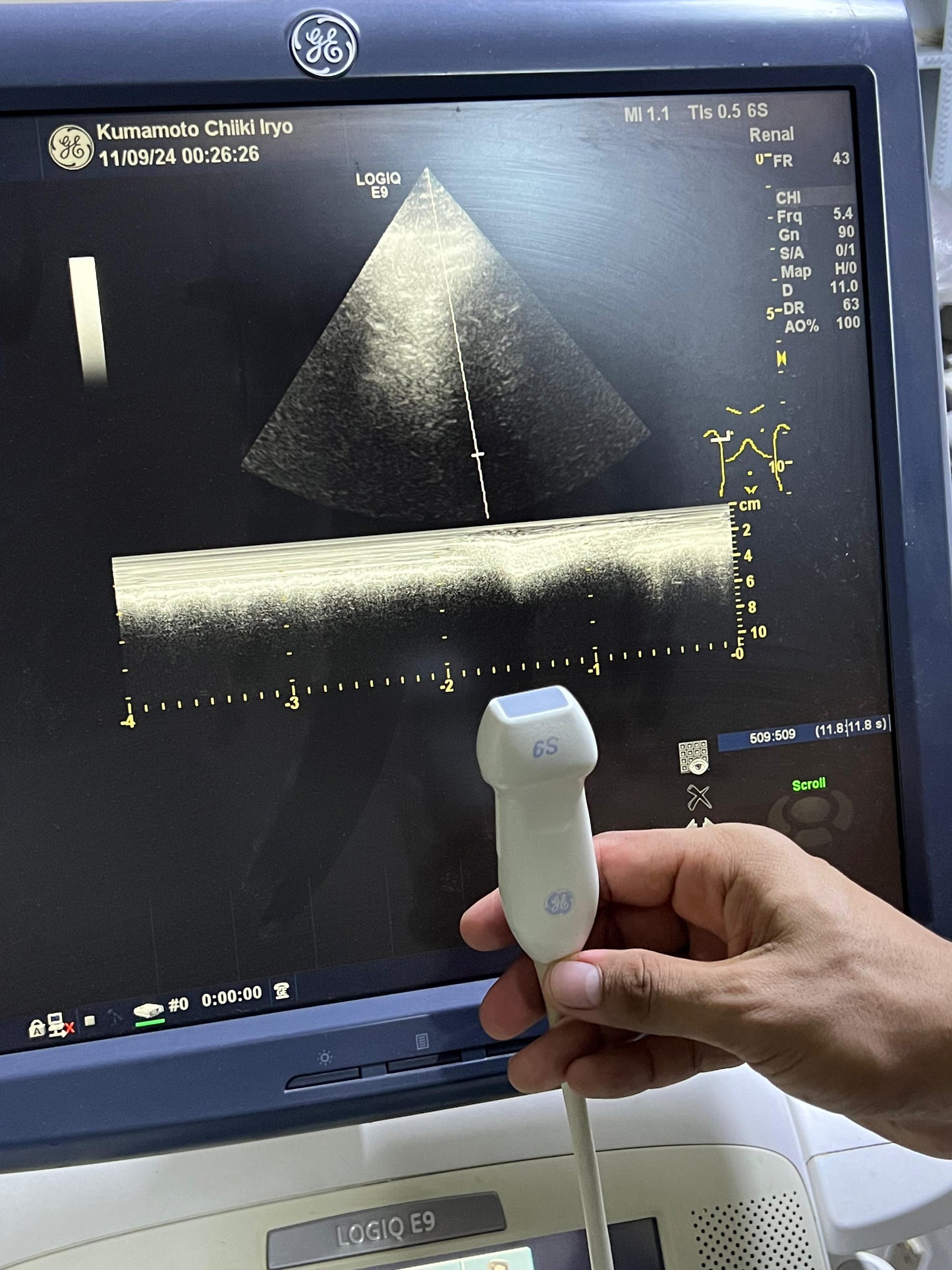 GE 6S-D Sector Array Probe Mfg: 2011