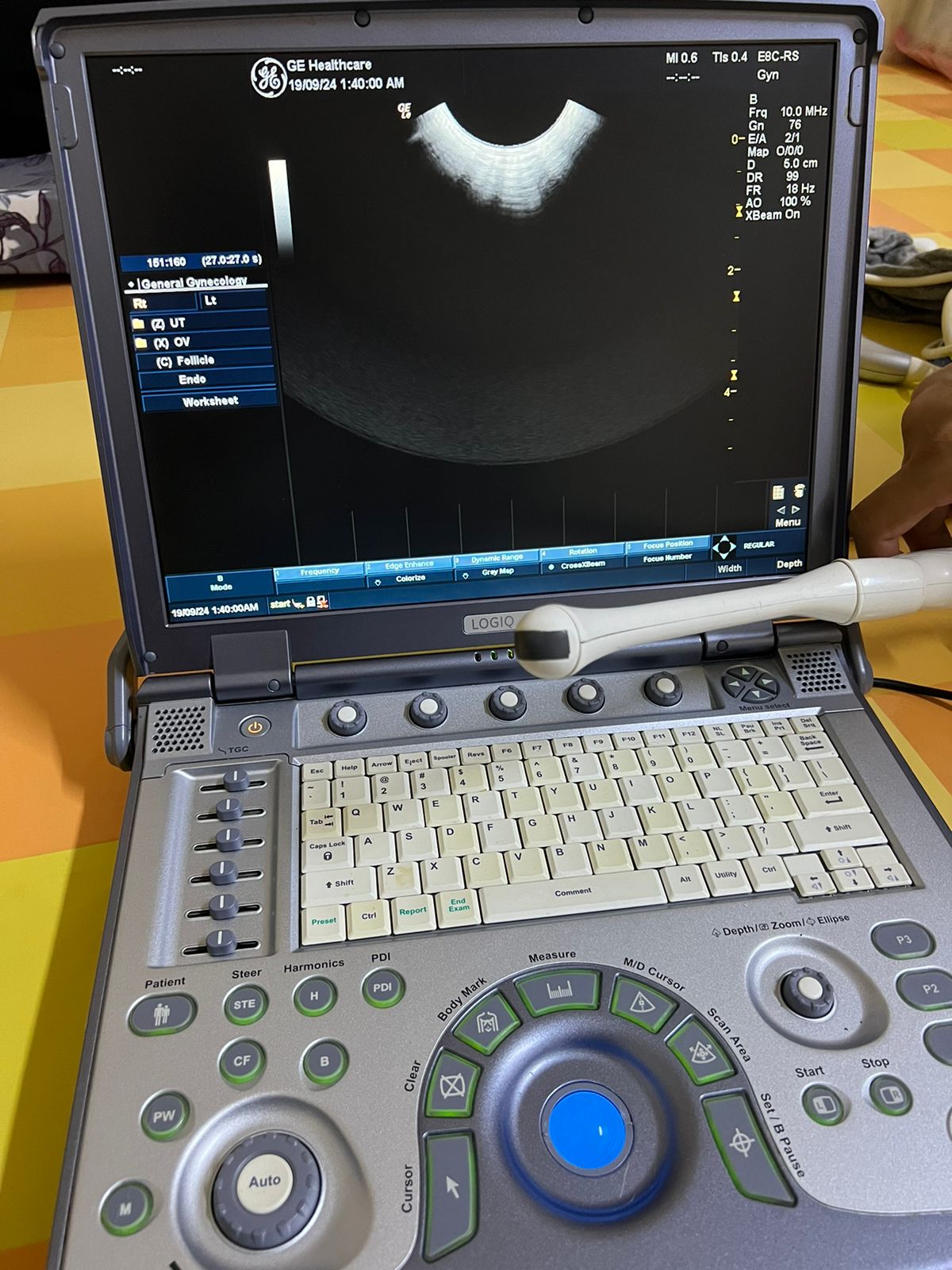 GE E8C-RS Probe, Transducer checked Mfg: 2015. 5/10