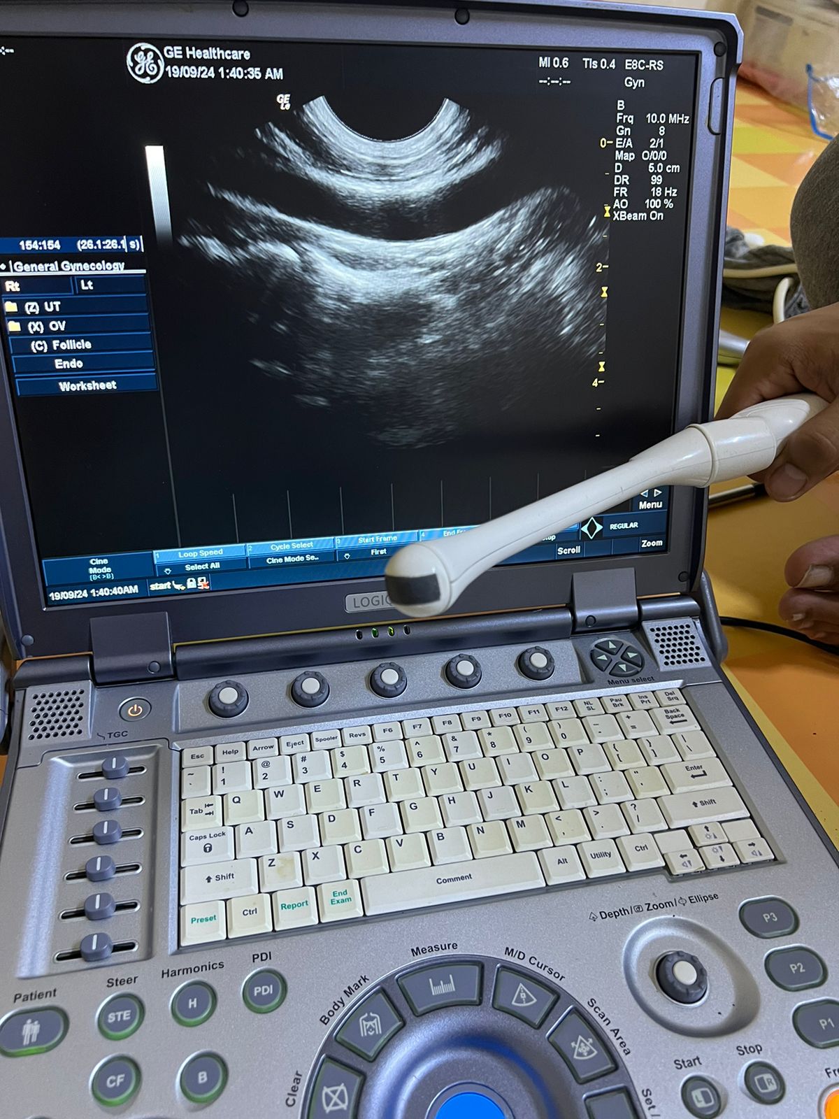 GE E8C-RS Probe, Transducer checked Mfg: 2015. 5/10