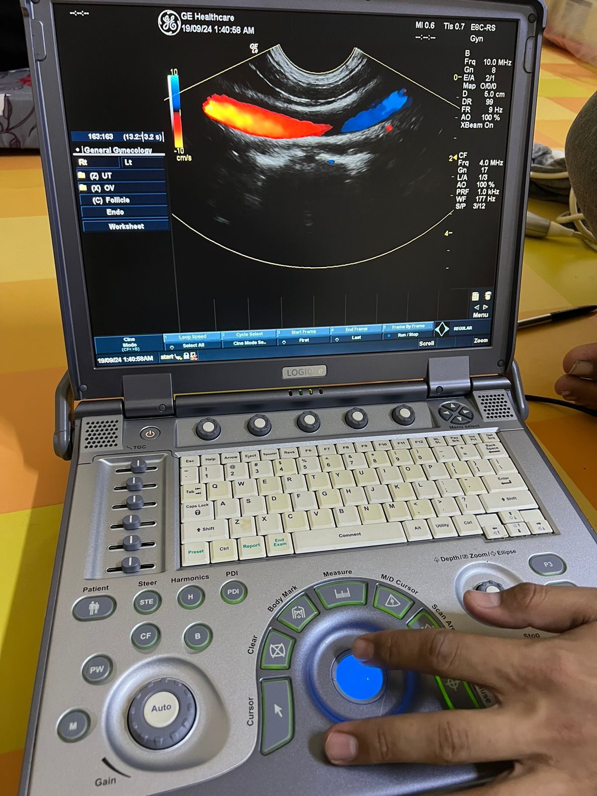 GE E8C-RS Probe, Transducer checked Mfg: 2015. 5/10