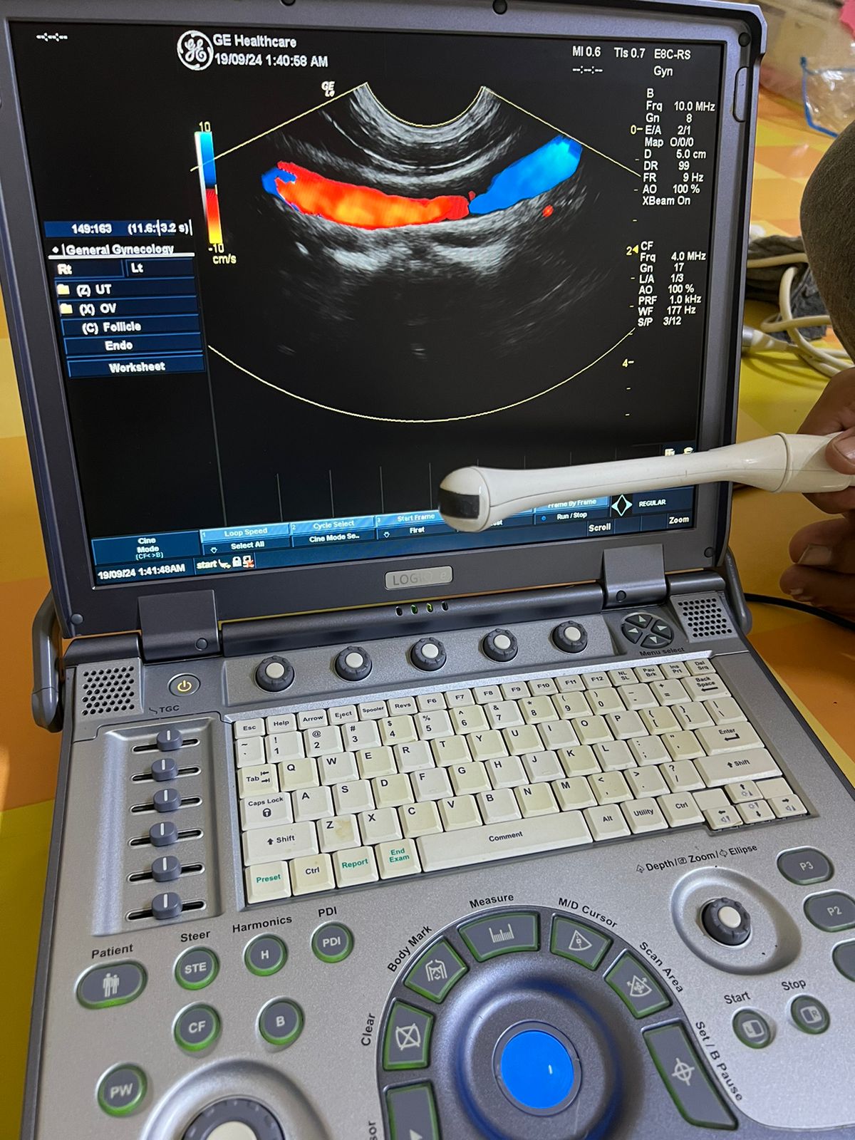 GE E8C-RS Probe, Transducer checked Mfg: 2015. 5/10