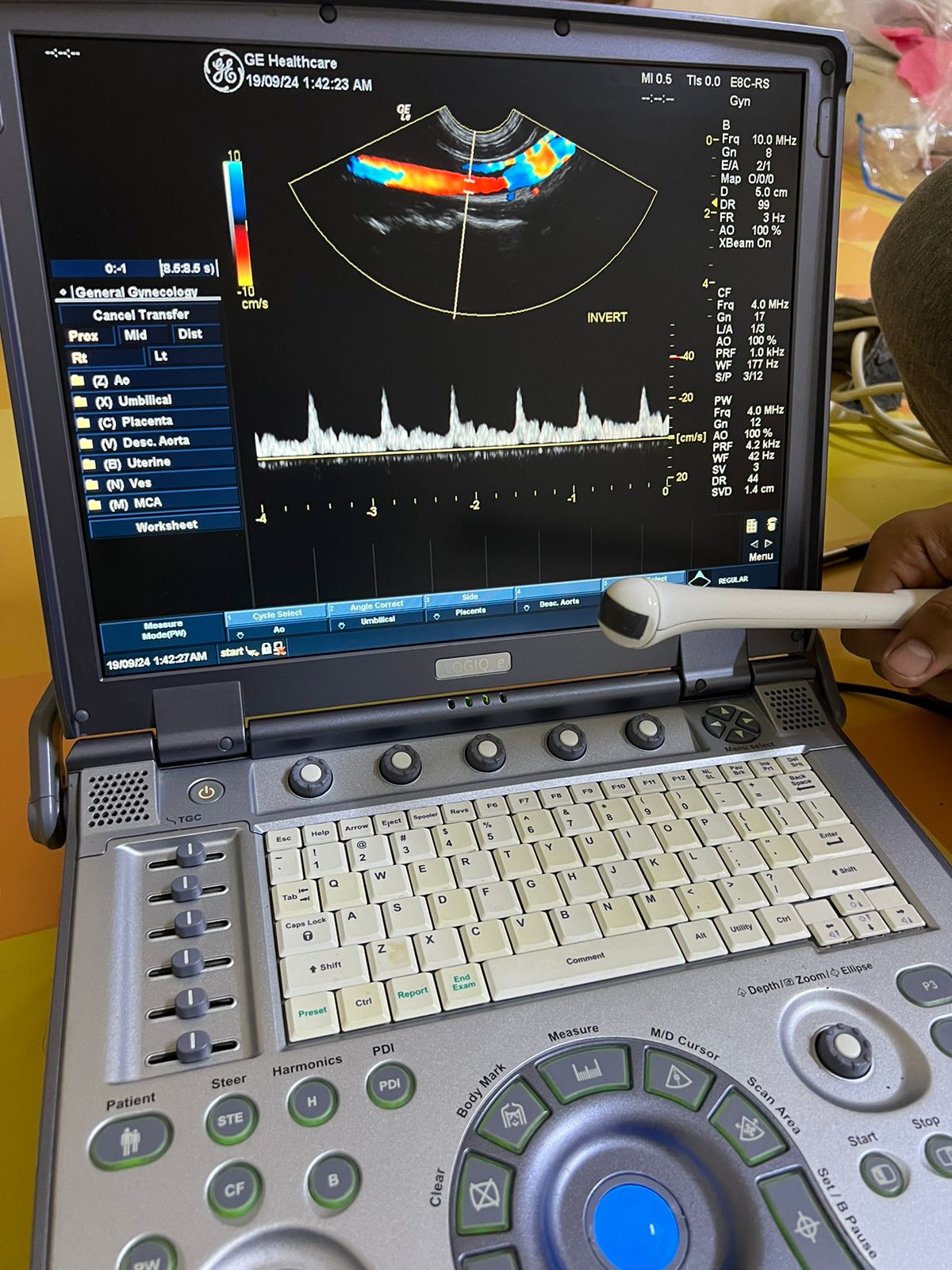 GE E8C-RS Probe, Transducer checked Mfg: 2015. 5/10