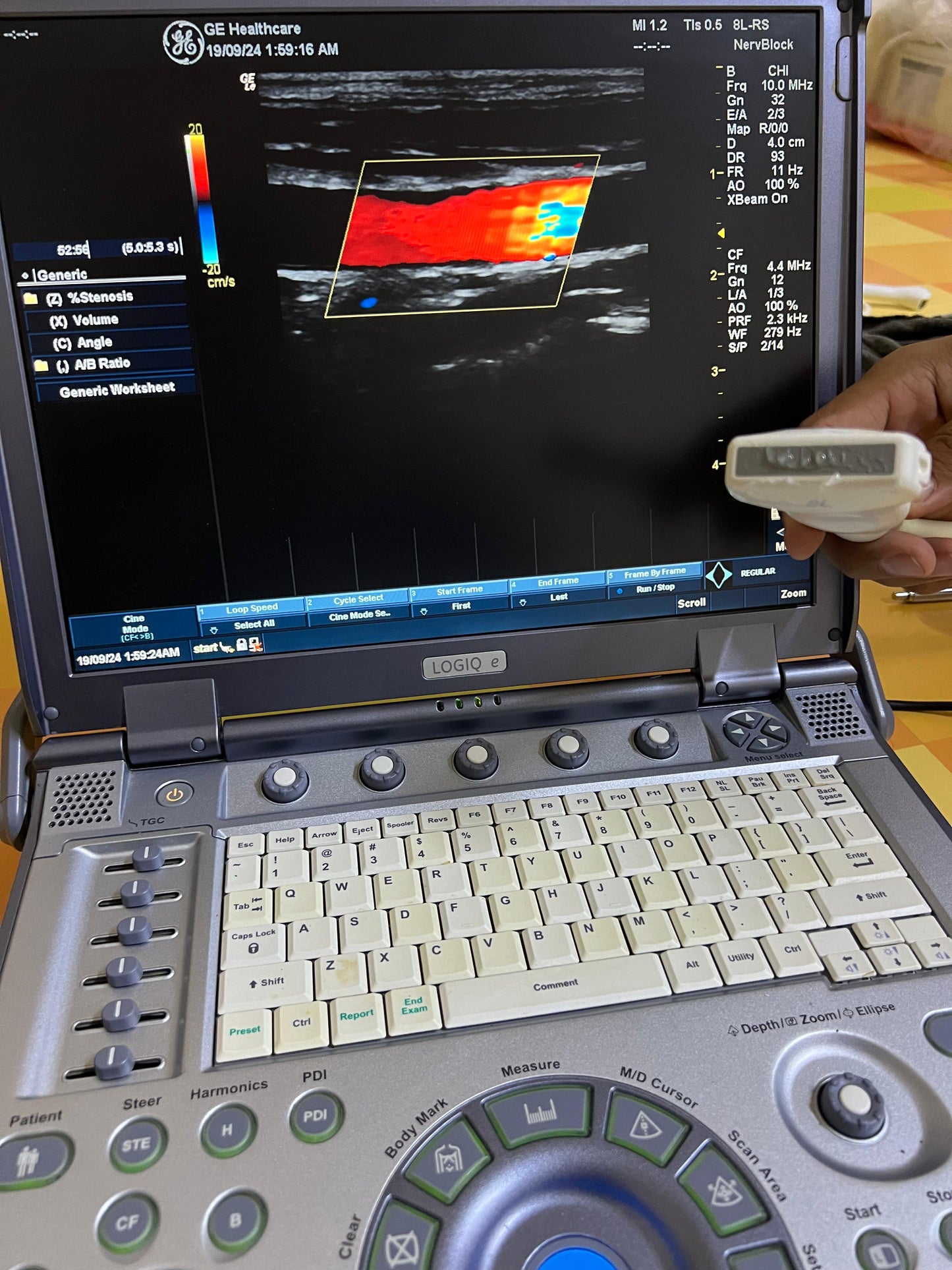 ..GE 8L-RS linear probe