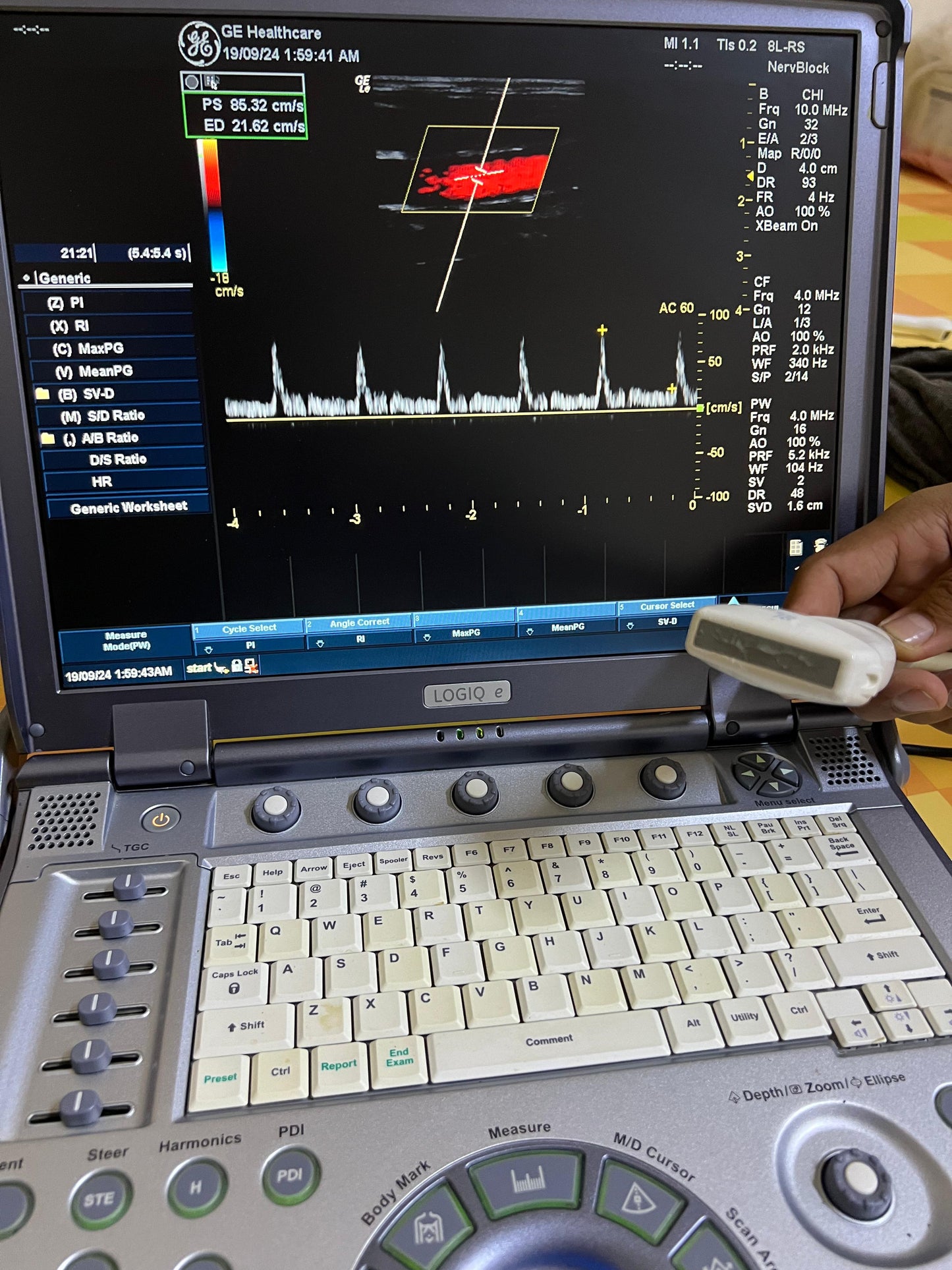 ..GE 8L-RS linear probe