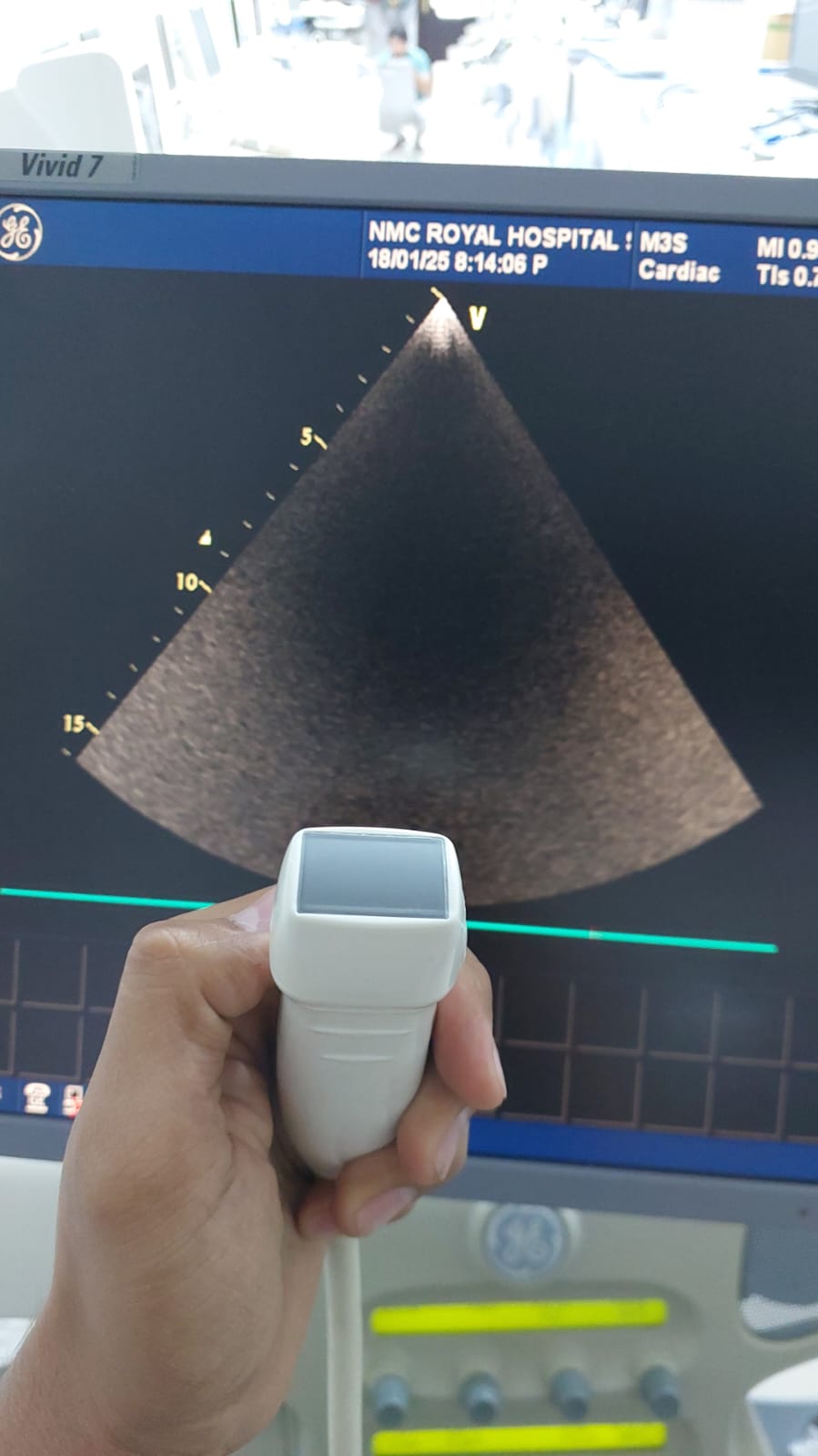 GE M3S cardiac probe (AV)