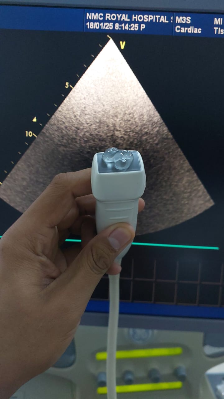 GE M3S cardiac probe (AV)