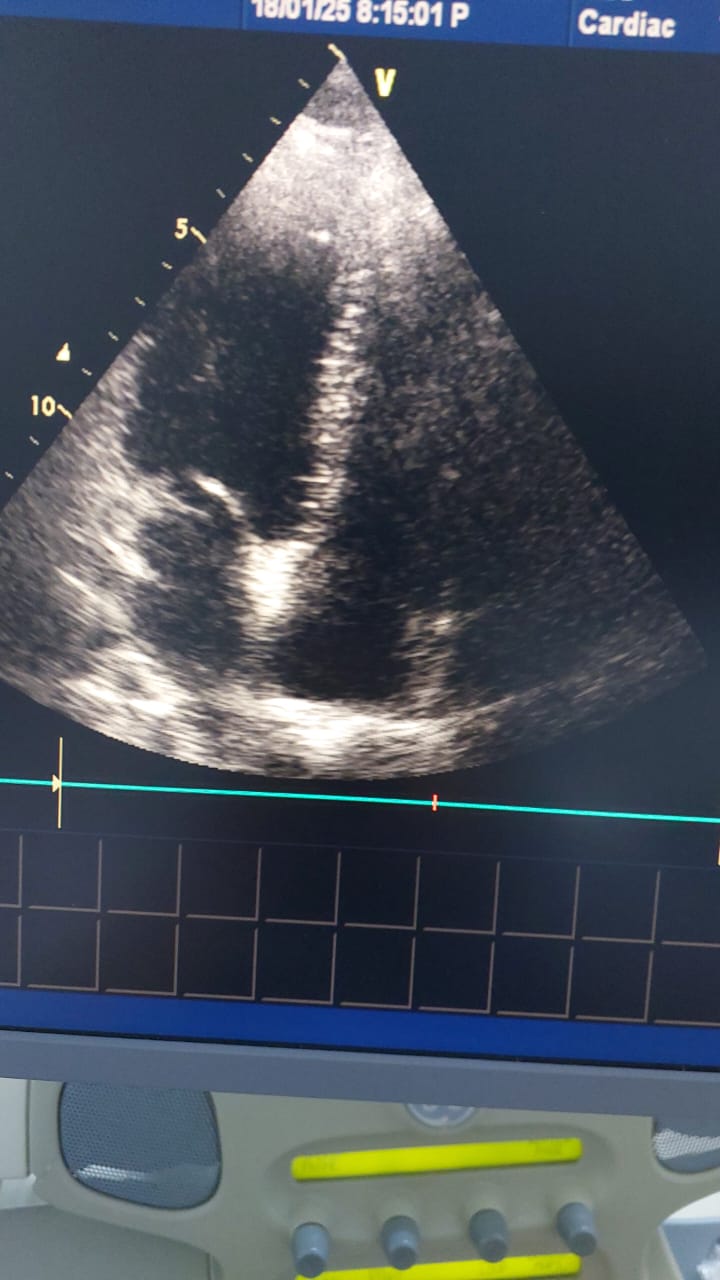 GE M3S cardiac probe (AV)