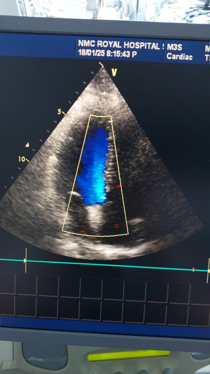 GE M3S cardiac probe (AV)