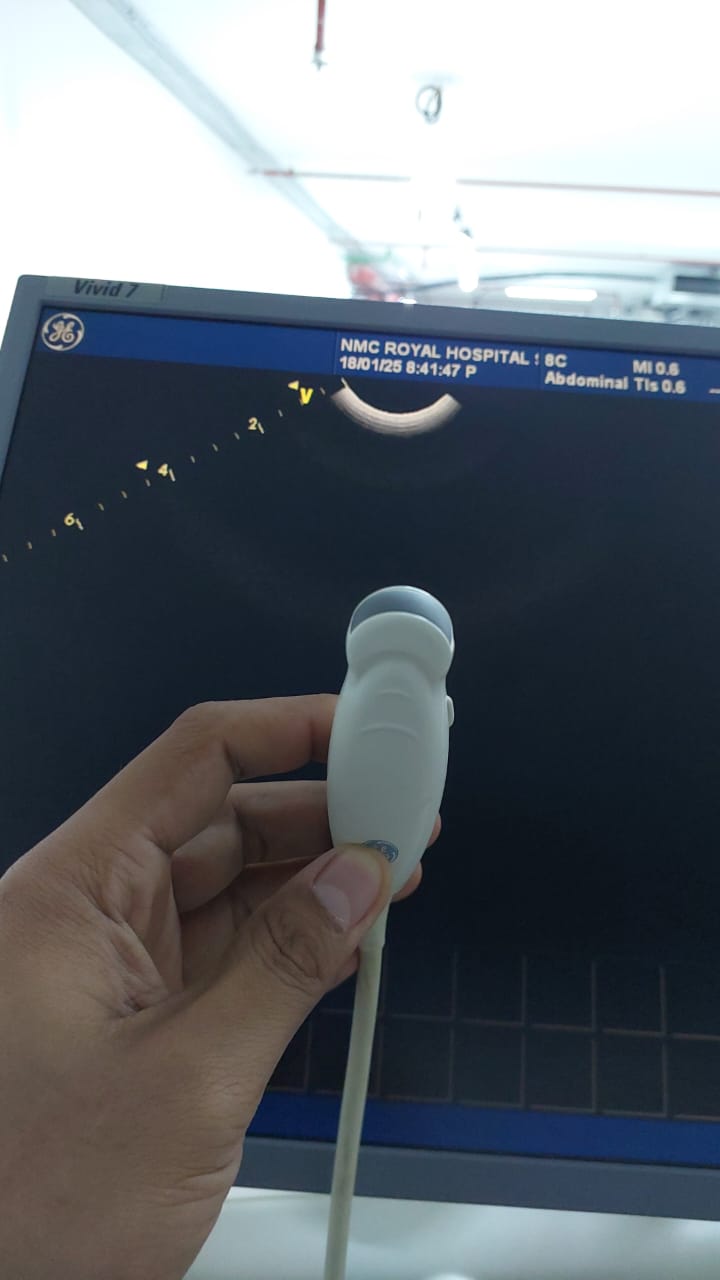 ..GE 8C micro convex array ultrasound transducer. Checked