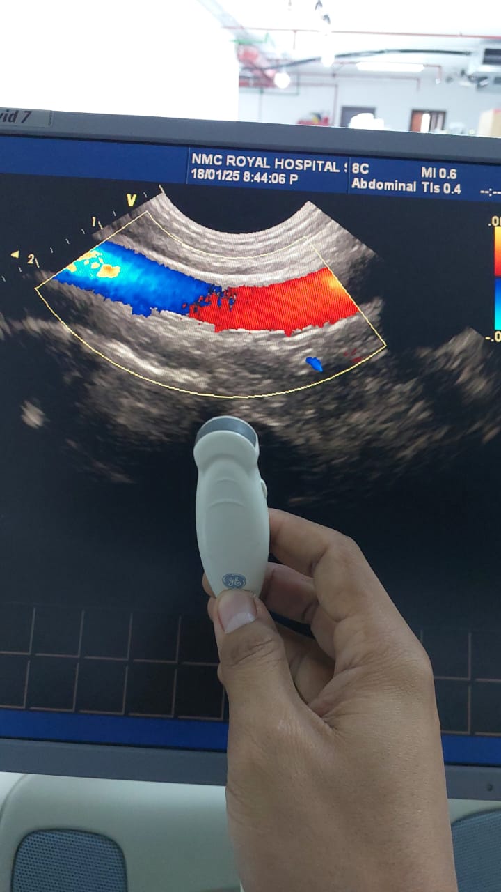 ..GE 8C micro convex array ultrasound transducer. Checked