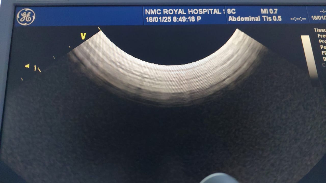 Z..GE 8C Convex Probe checked