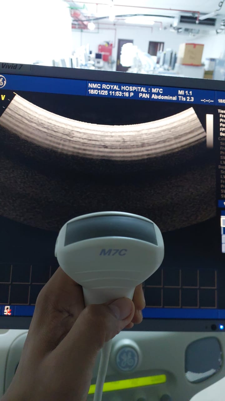 ..GE M7C convex probe checked and ok