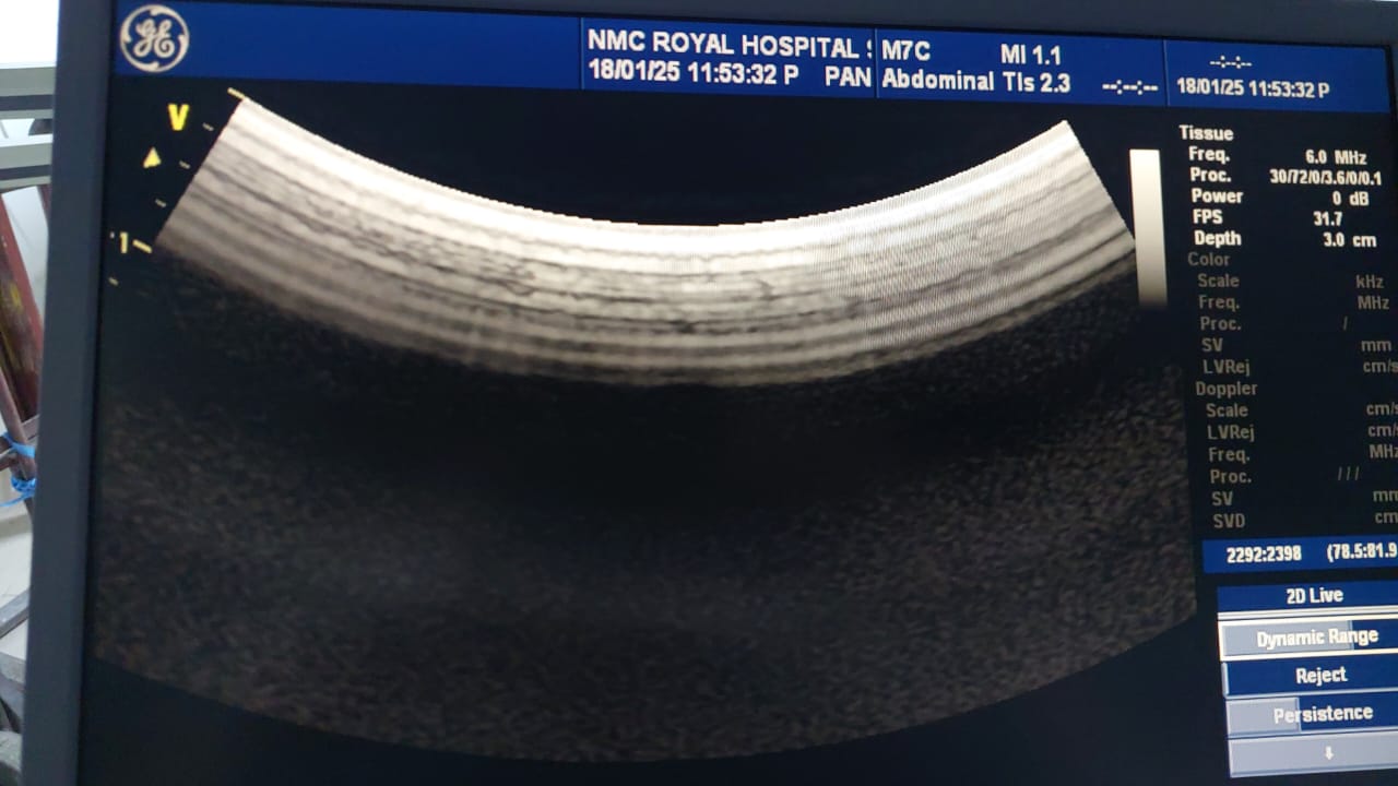 ..GE M7C convex probe checked and ok