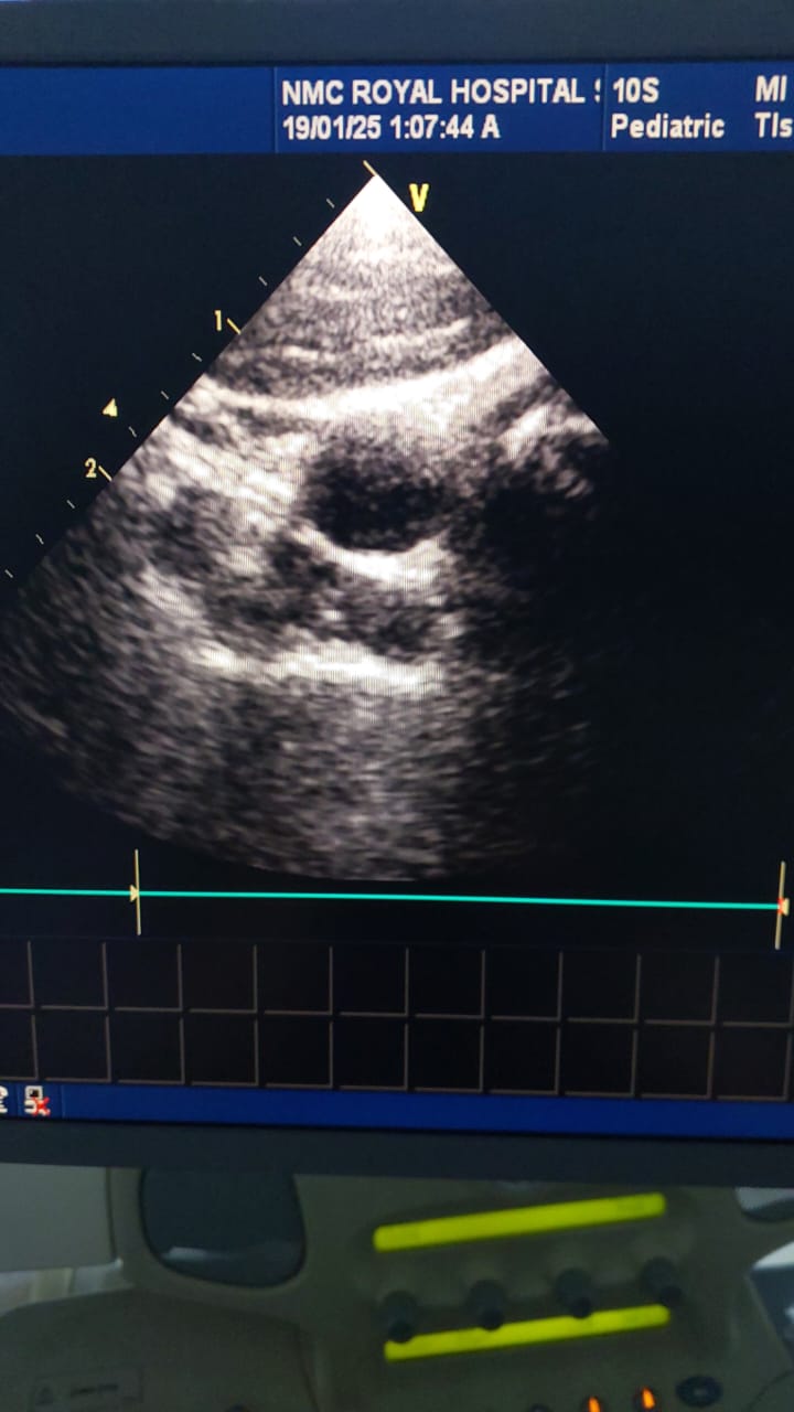 ..GE 10S cardiac probe. Checked and ok