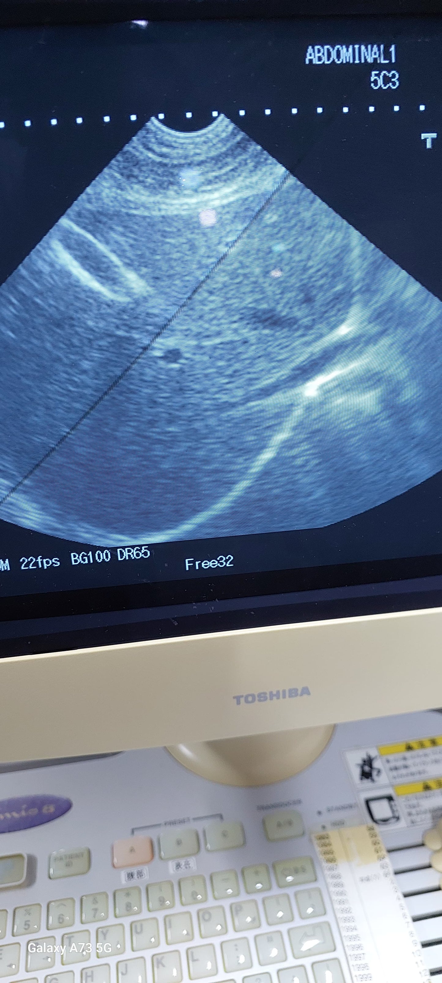 PVQ-381A Curved array / microconvex transducer for Famio 8 ultraosund checked DXB