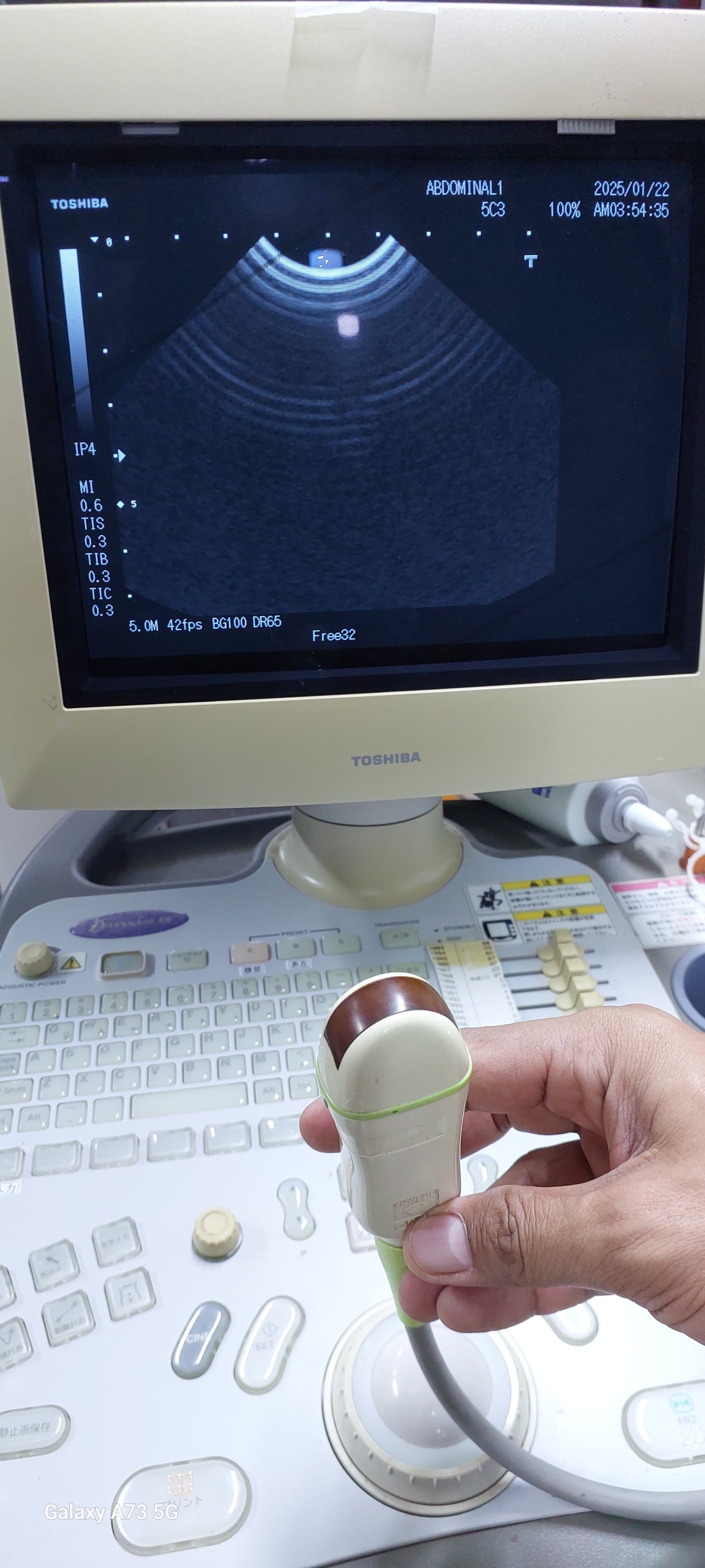 PVQ-381A Curved array / microconvex transducer for Famio 8 ultraosund checked DXB