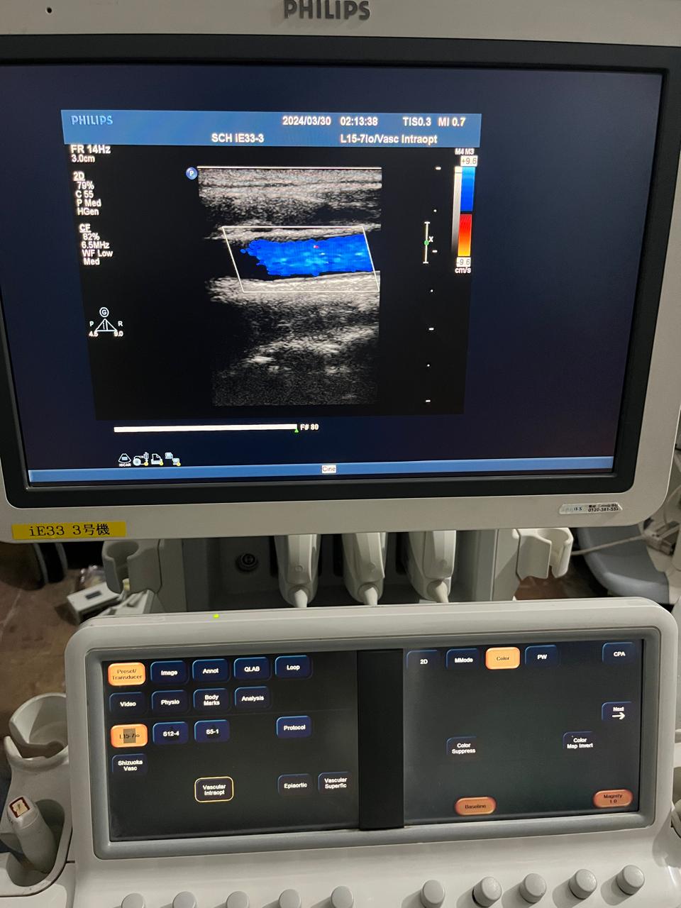..Philips L15-7io broadband ccompact linear array probe