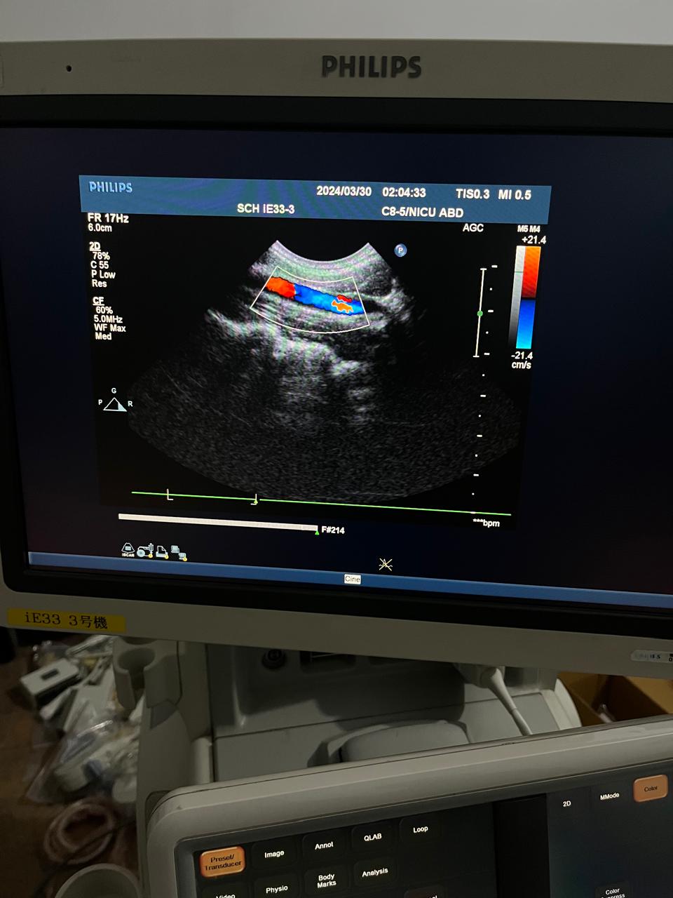..Philips C8-5 microconvex probe
