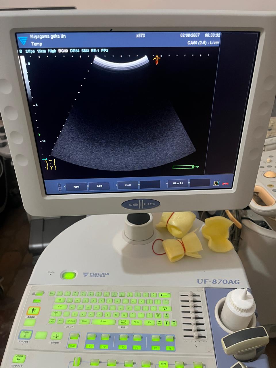 Z. .Fukuda Denshi FUT-CA602-5A convex probe - Japan Medical Company LTD