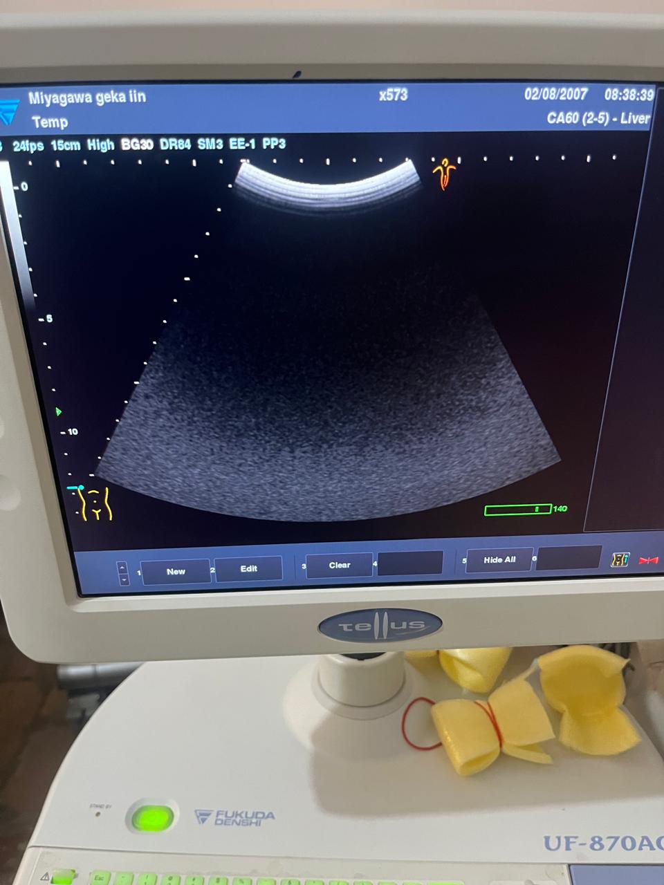Z. .Fukuda Denshi FUT-CA602-5A convex probe - Japan Medical Company LTD