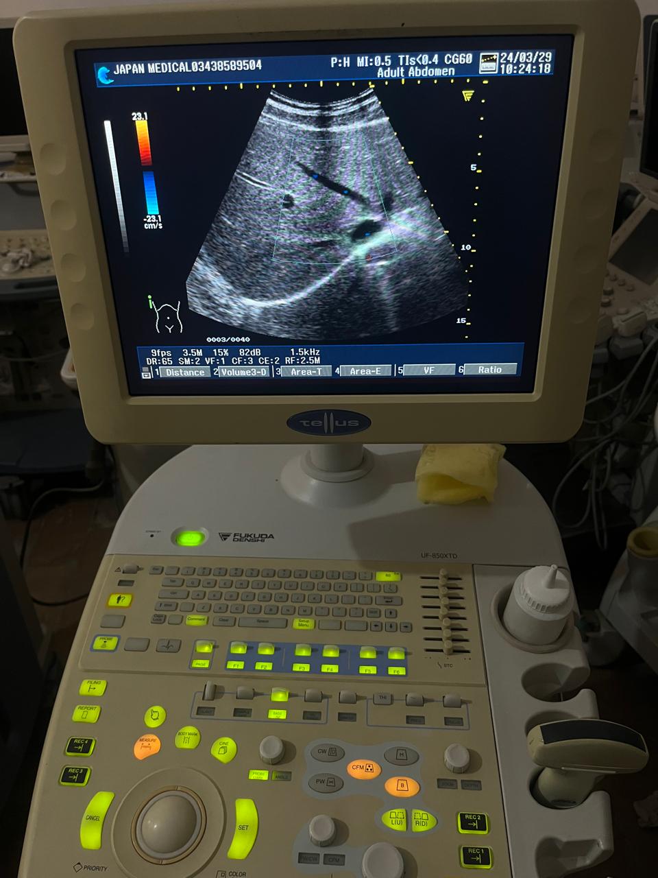 Z..Fukuda FUT-CG602-5A Convex Probe checked dxb