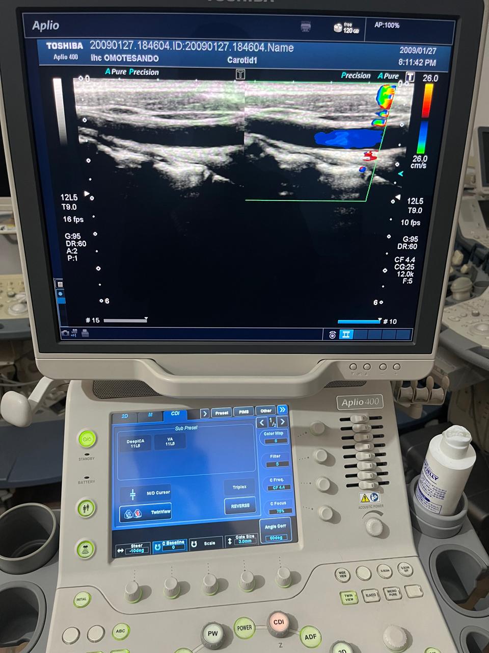 Z..Toshiba PLT-805AT linear probe checked DXB