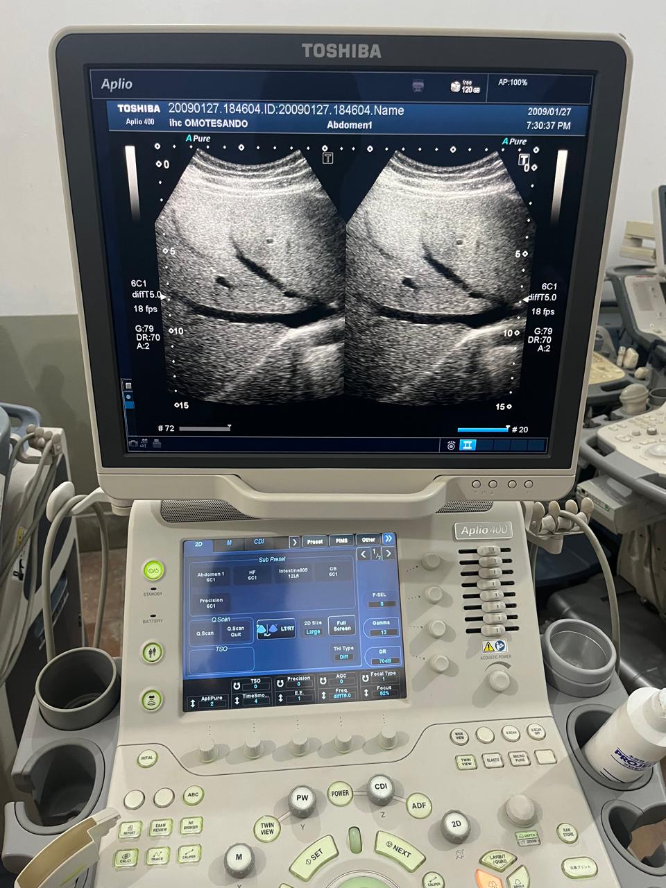Z..Toshiba PVT-375BT Convex Probe checked DXB