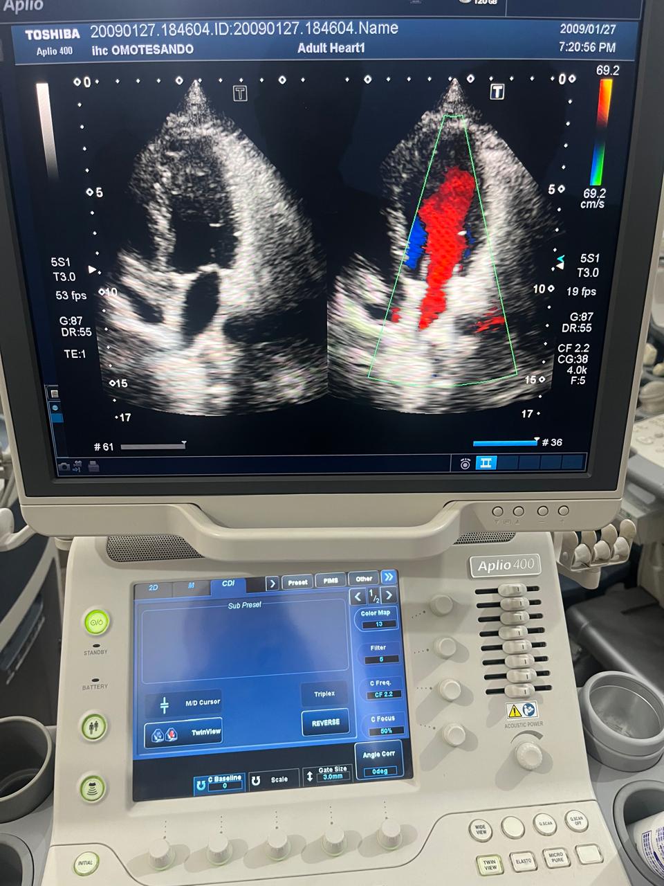 Z..Toshiba PST-25BT Cardiac Probe