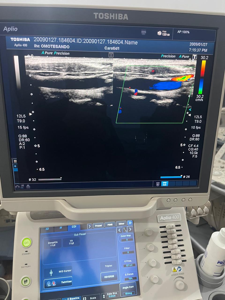 Z..Toshiba PLT-805AT linear probe checked DXB