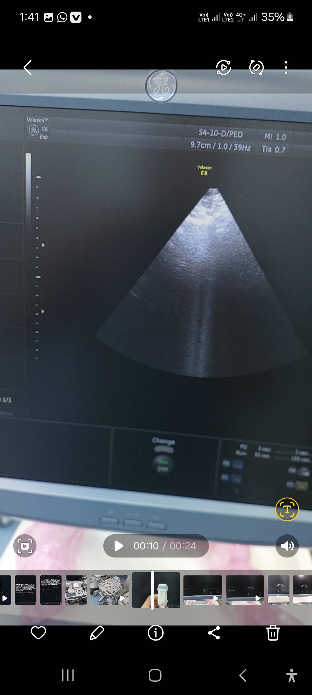 ..GE S4-10-D cardiac probe Mfg: 2014 (AV)