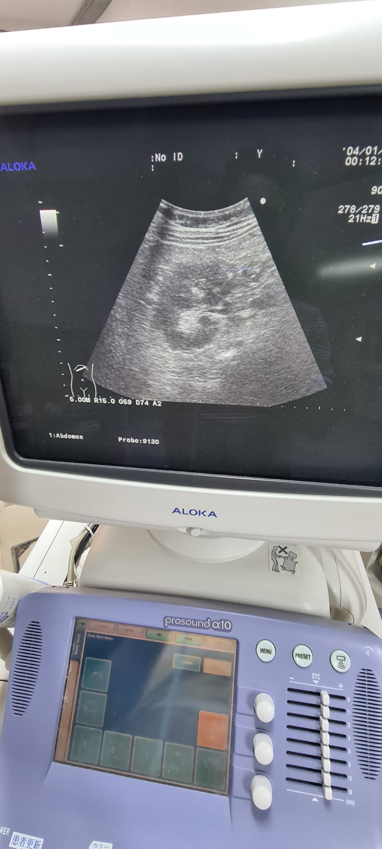 Aloka UST-9130 CONVEX checked Av. SN. X0061338