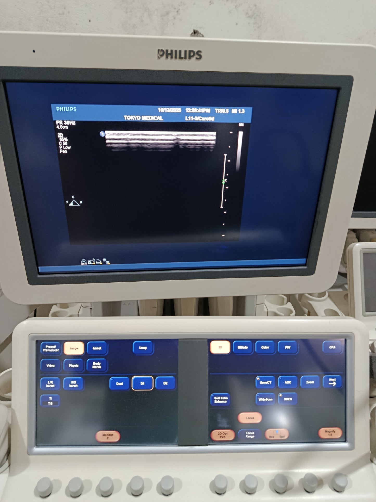 P.. Phillips L11-3 Linear Probe