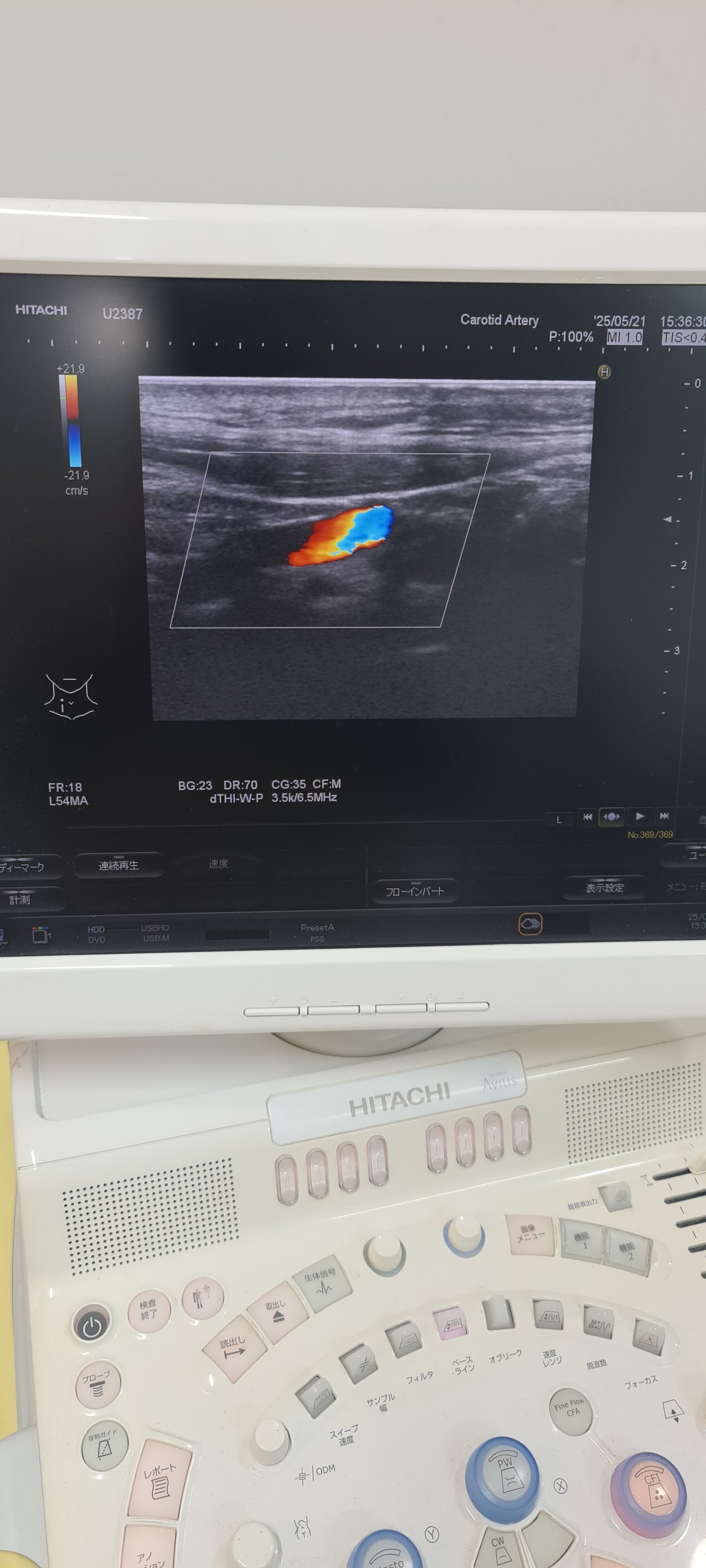 ..Hitachi EUP-L54MA linear probe Checked